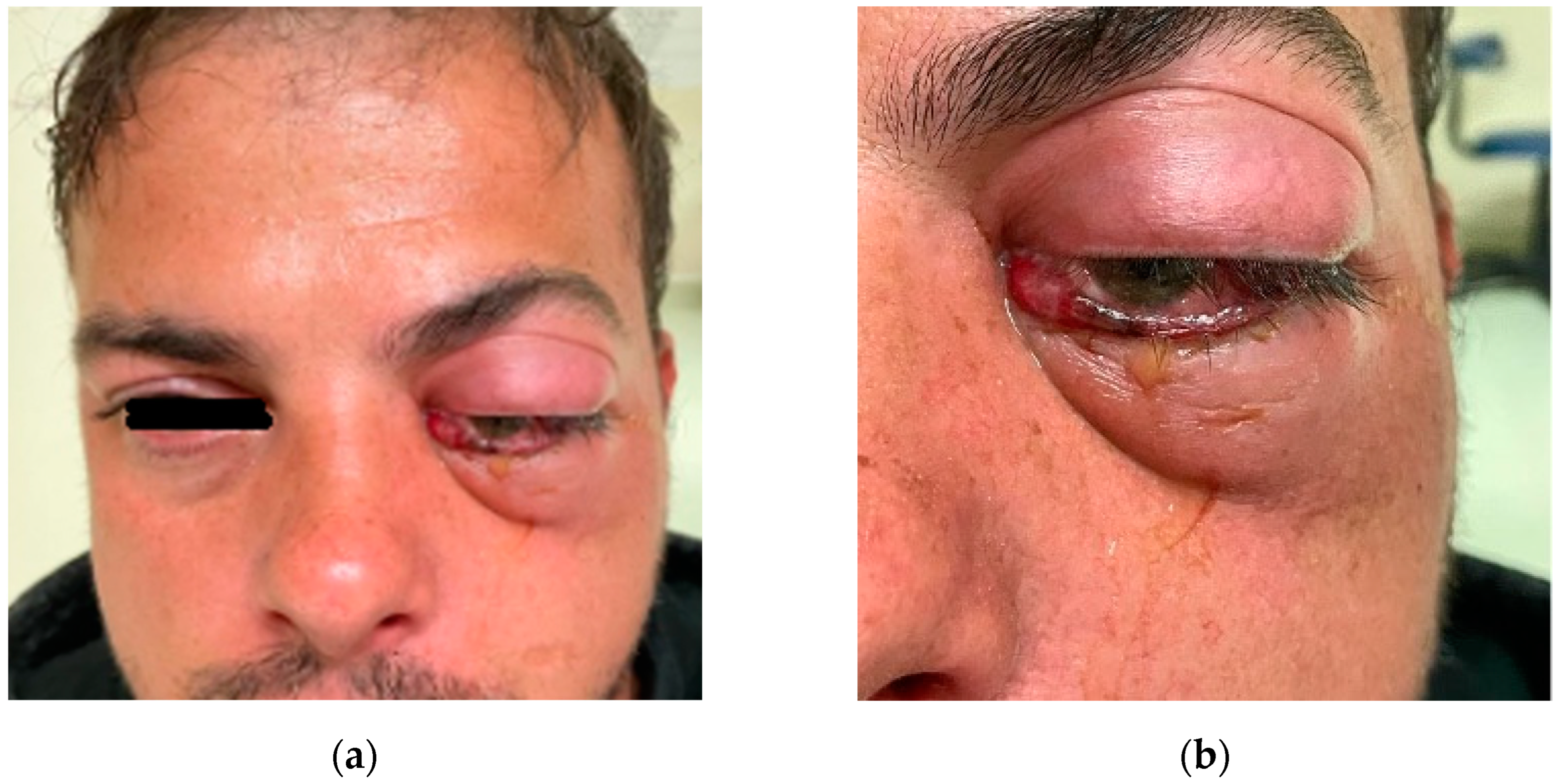 Diagnostics 14 01391 g009