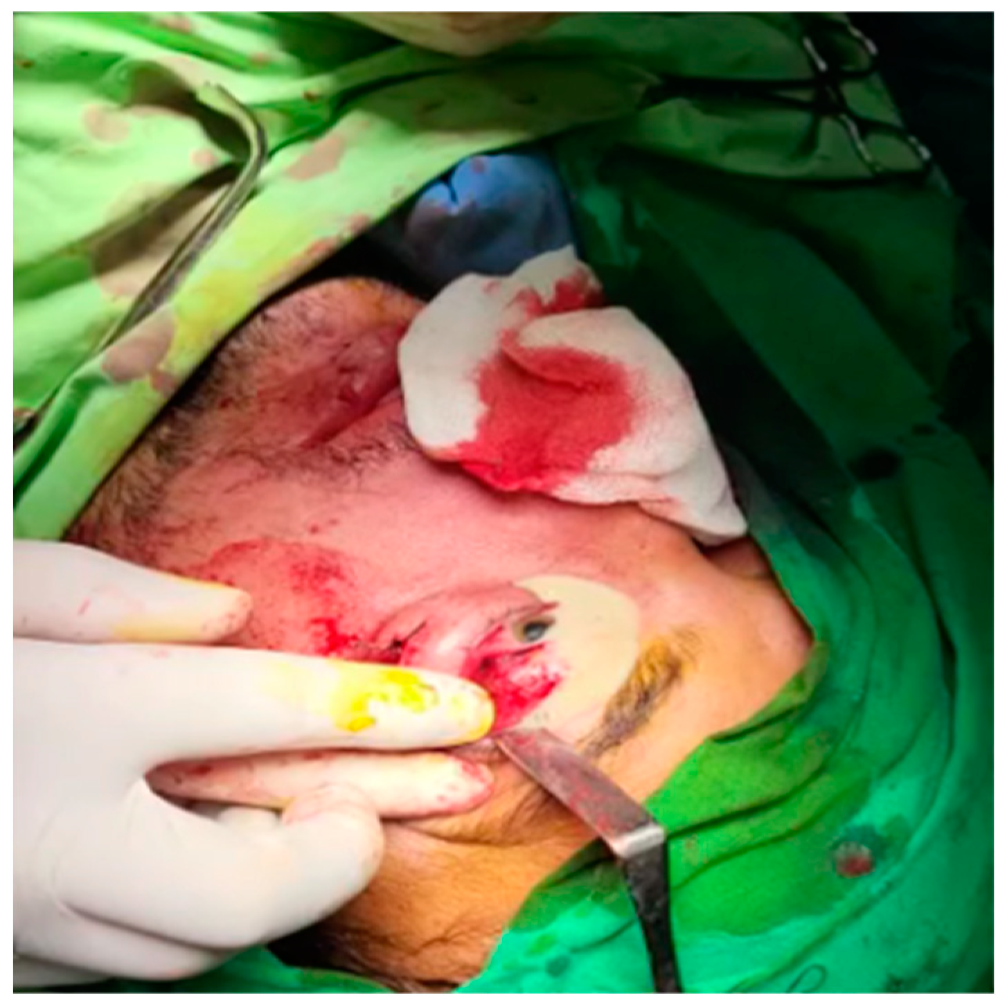 Diagnostics 14 01391 g011