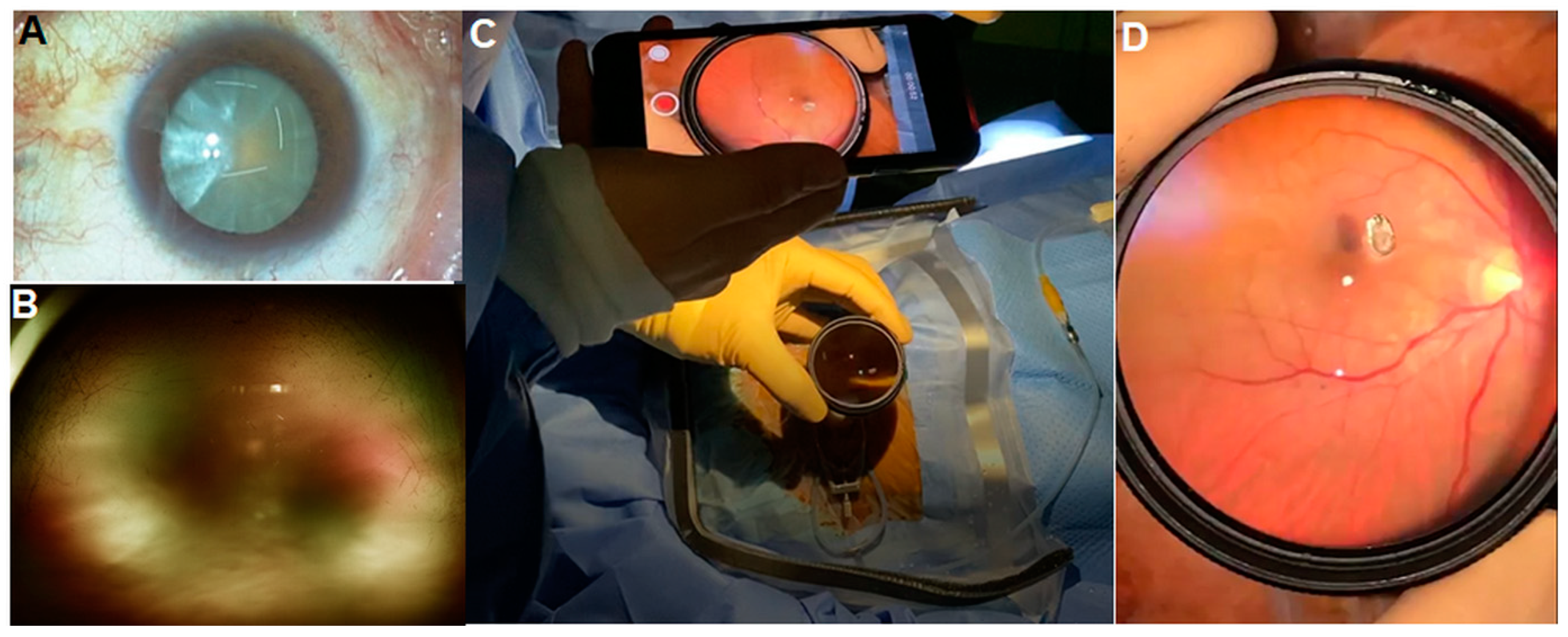 Diagnostics 14 01395 g003