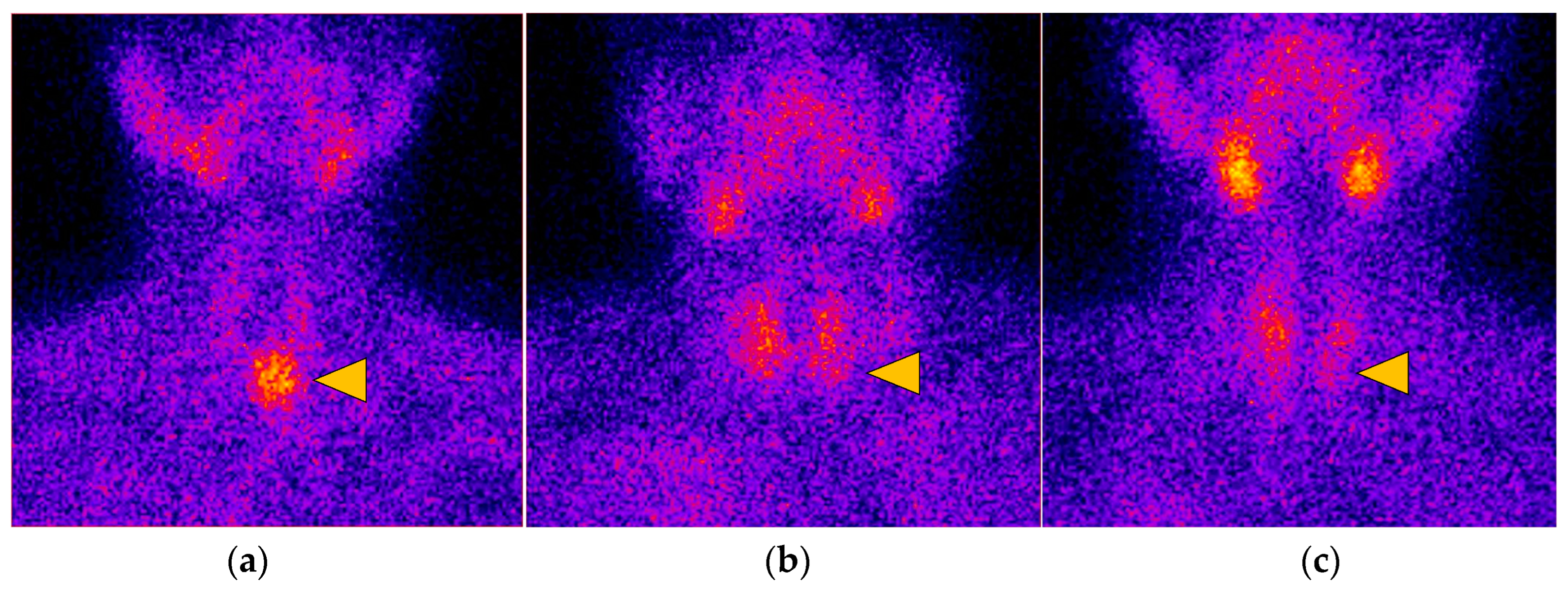 Diagnostics 14 01398 g002 Diagnostics 14 01398 g002