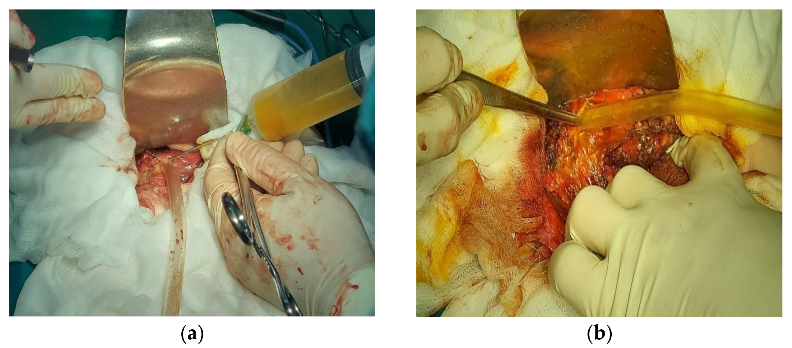 Diagnostics 14 01399 g001