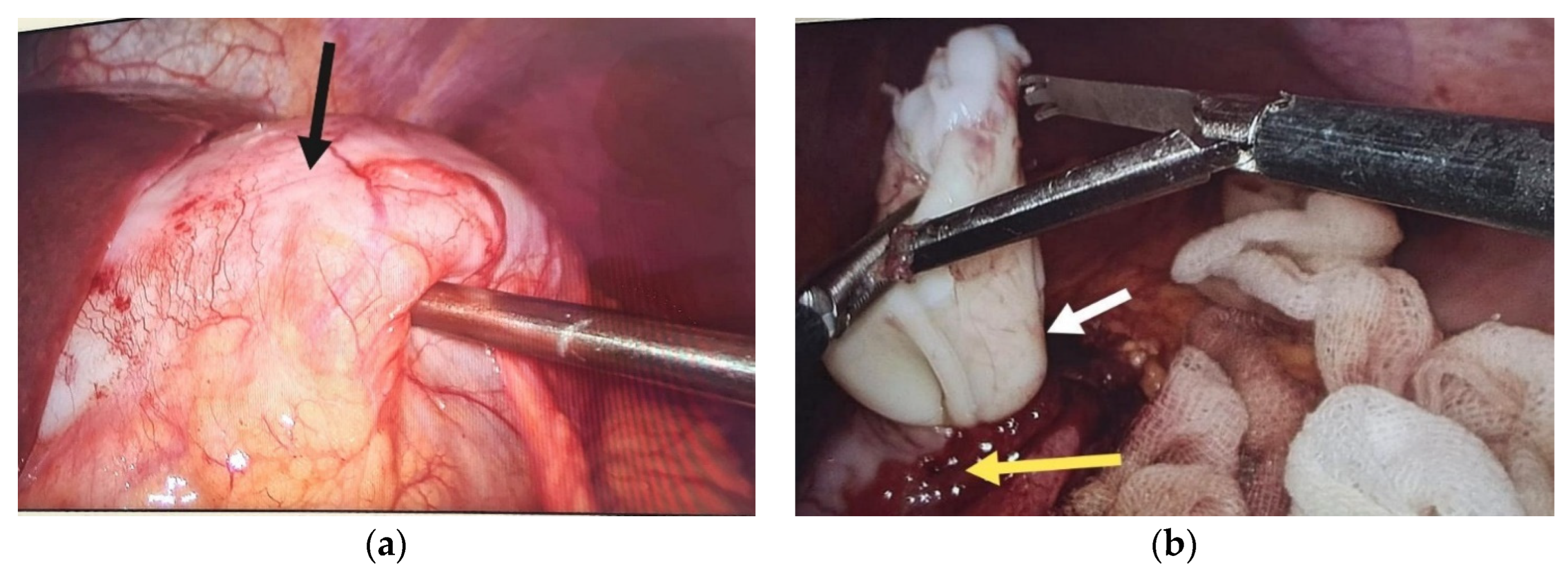 Diagnostics 14 01399 g002