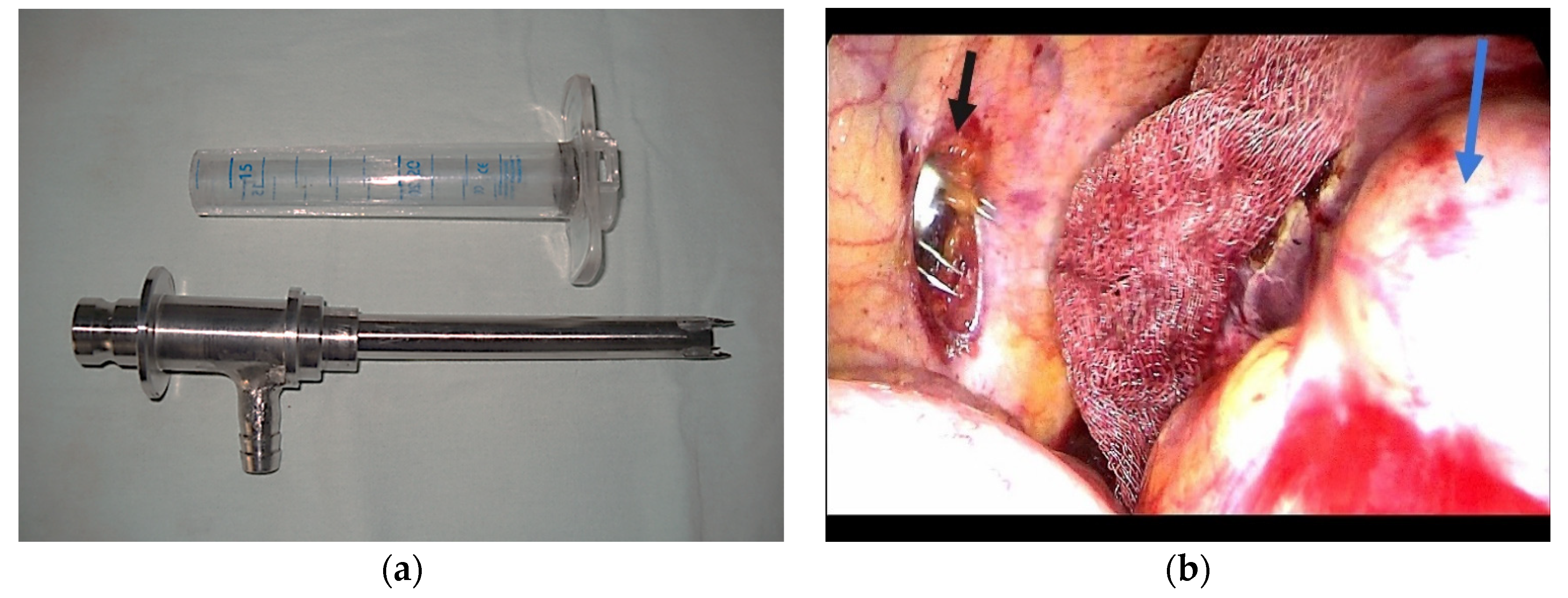 Diagnostics 14 01399 g004