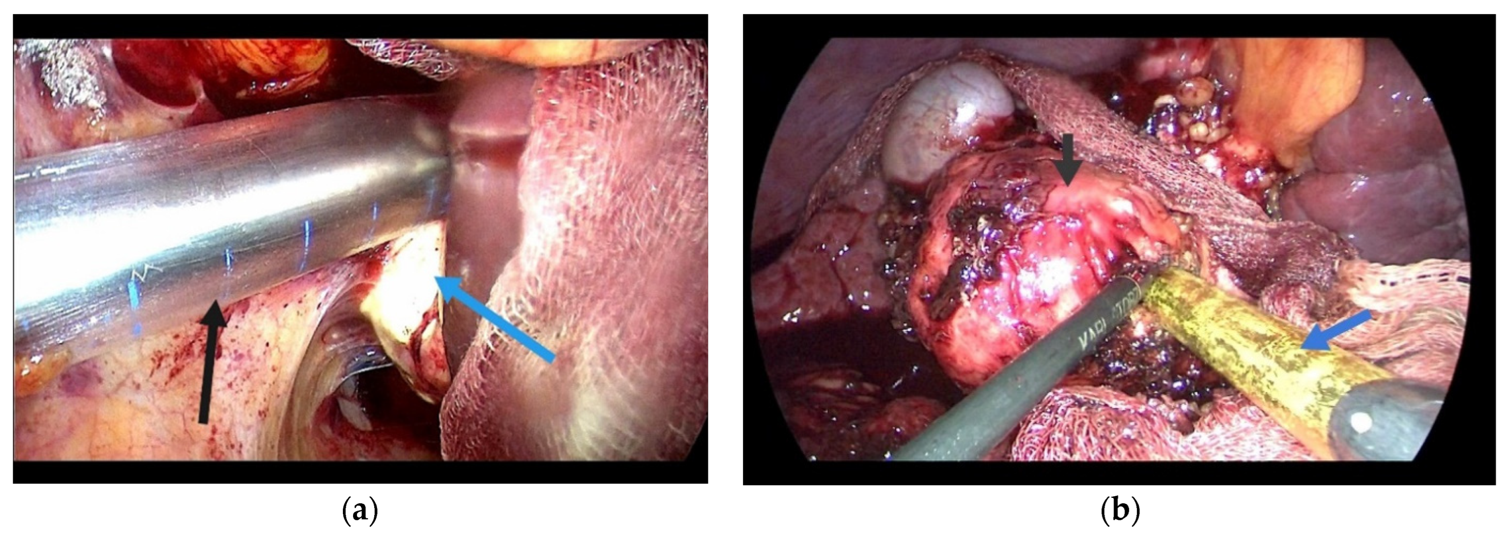 Diagnostics 14 01399 g005