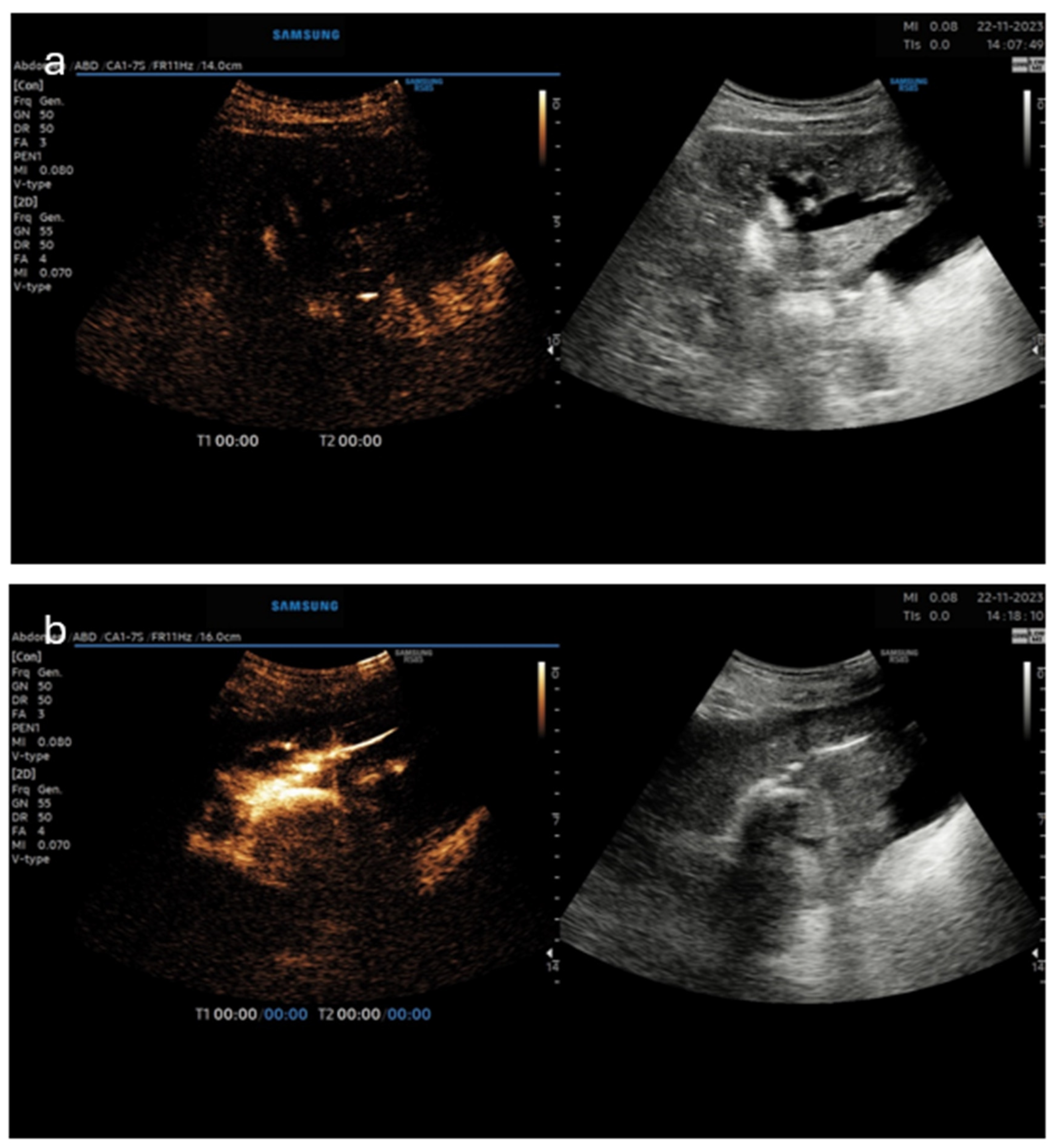 Diagnostics 14 01400 g002 Diagnostics 14 01400 g002