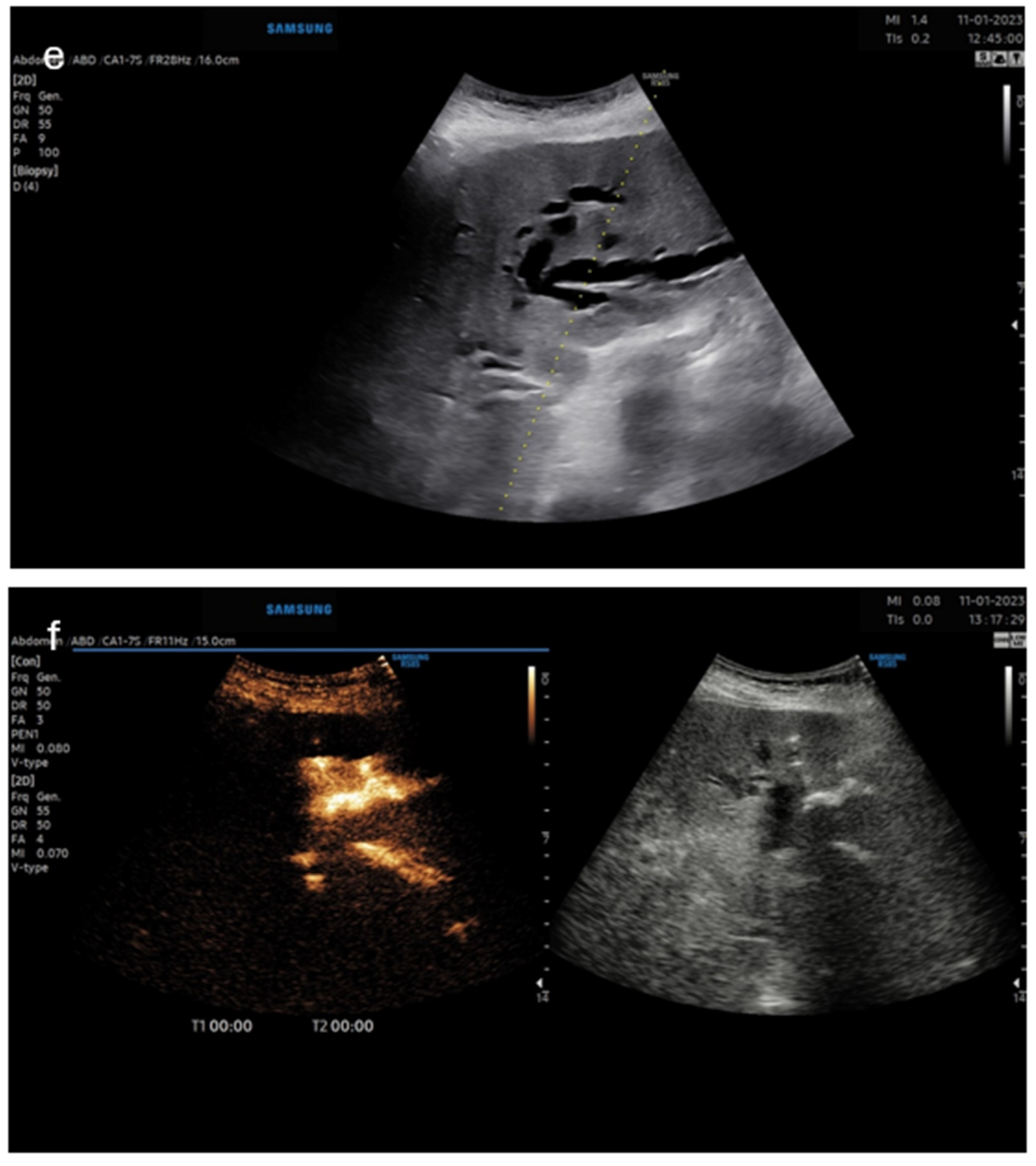 Diagnostics 14 01400 g004 Diagnostics 14 01400 g004