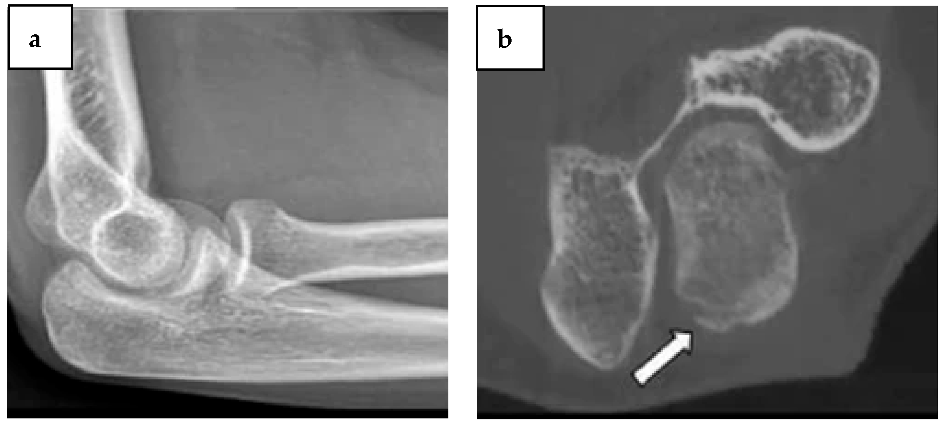 Diagnostics 14 01404 g002