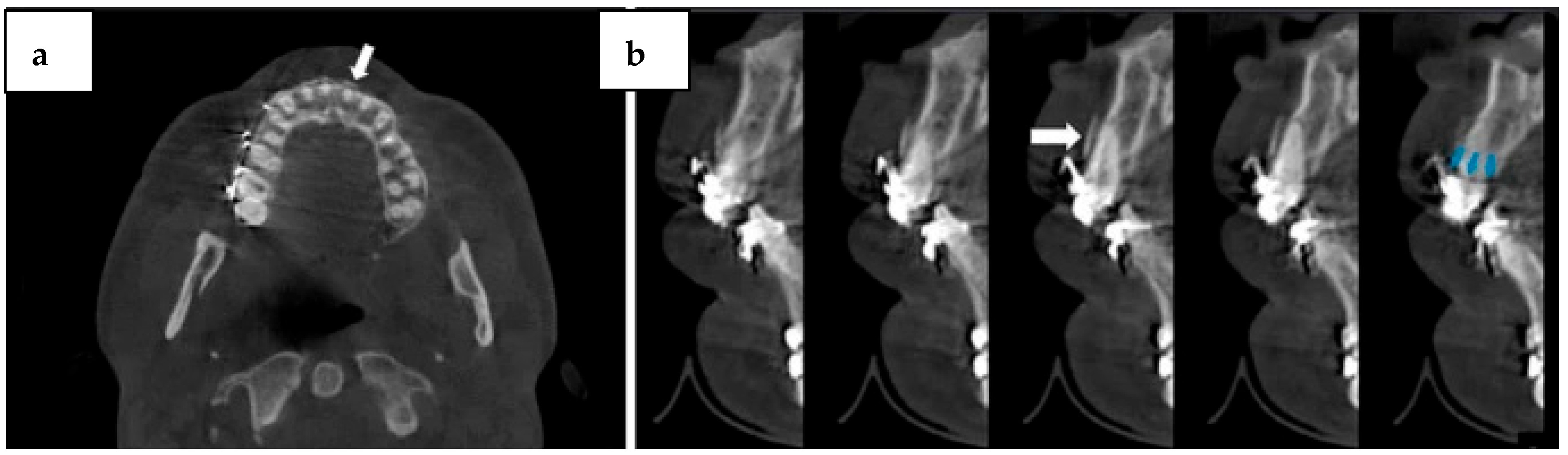 Diagnostics 14 01404 g005