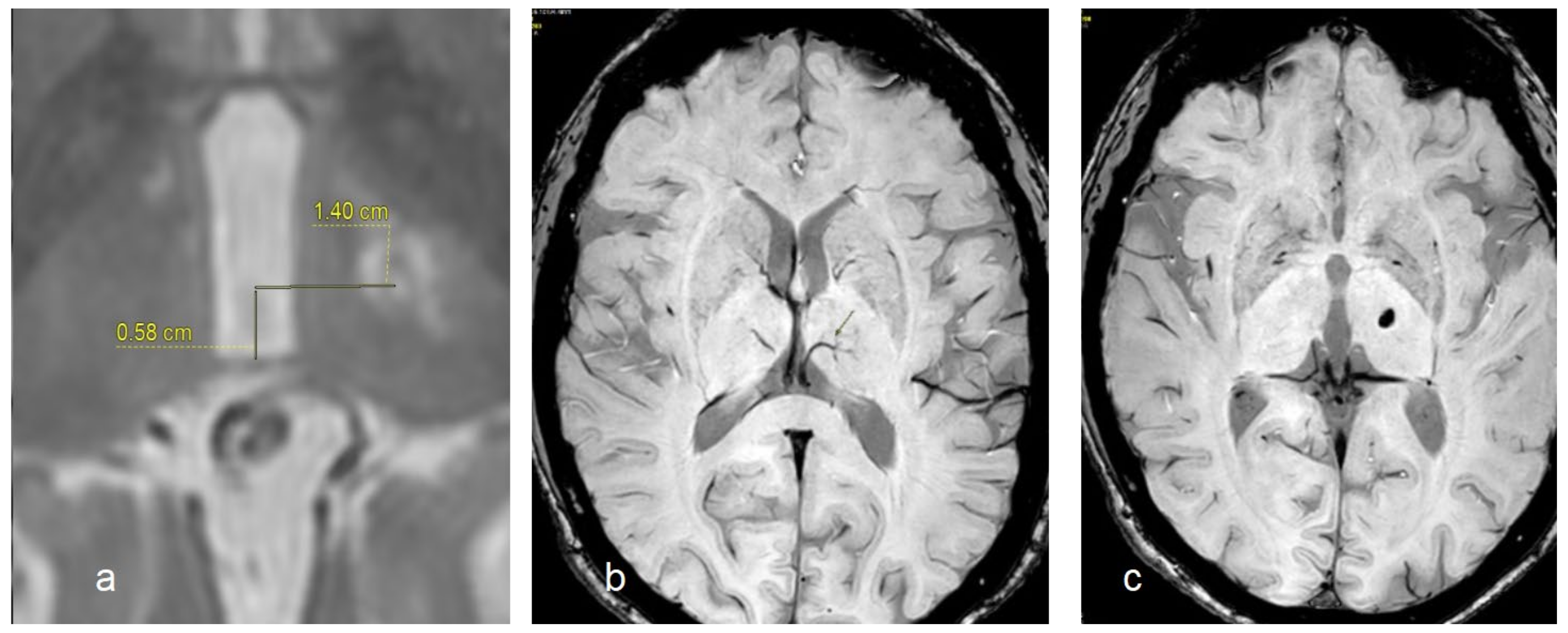 Diagnostics 14 01409 g001