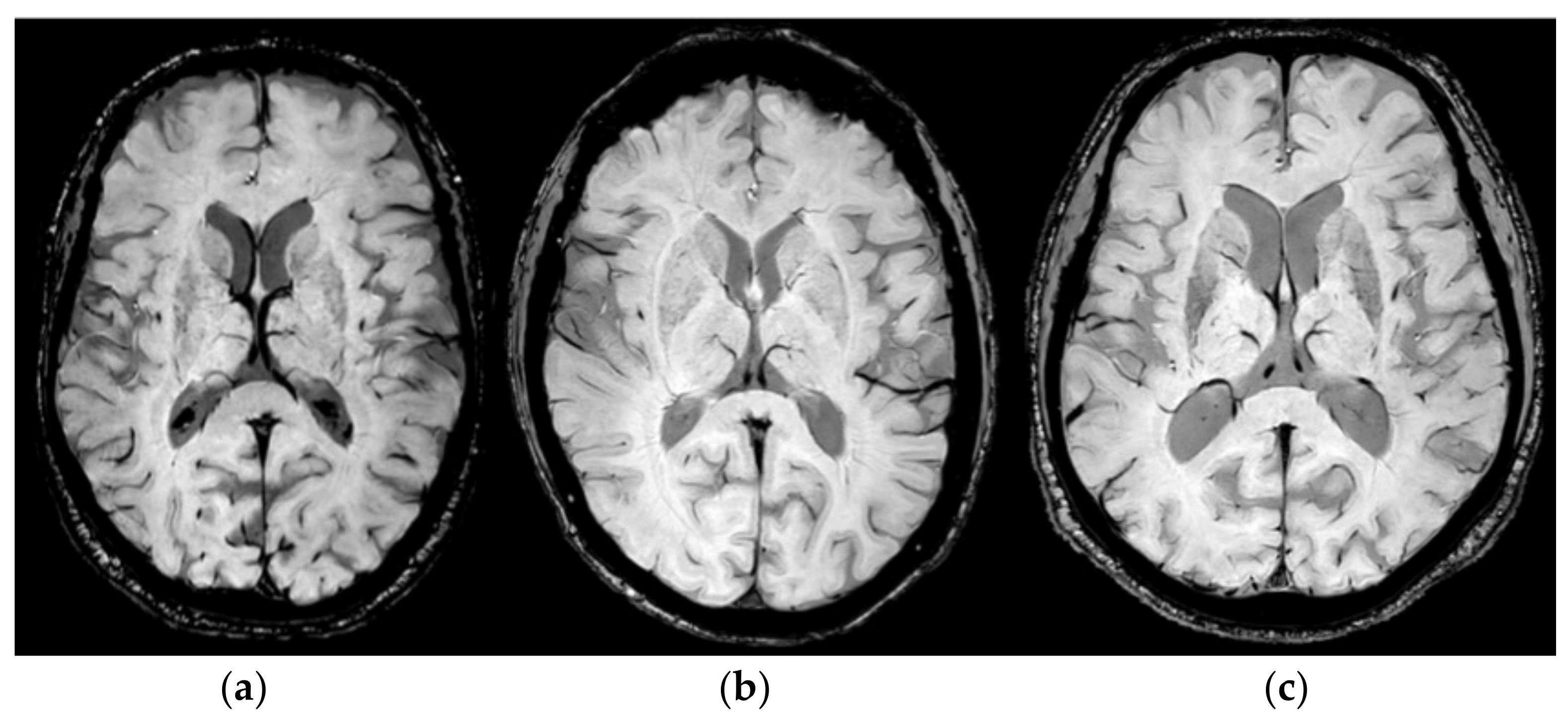 Diagnostics 14 01409 g004
