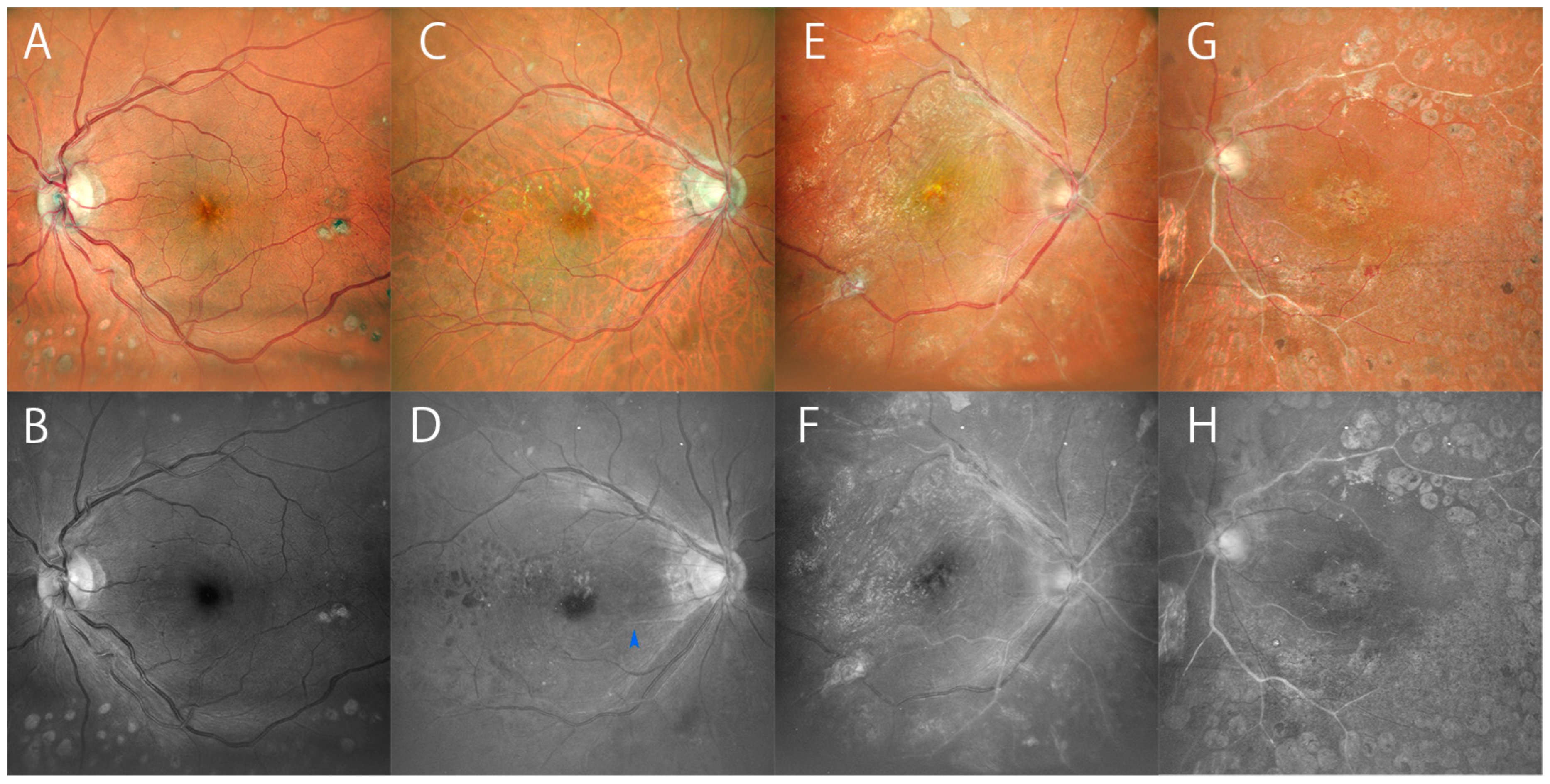 Diagnostics 14 01411 g002 Diagnostics 14 01411 g002