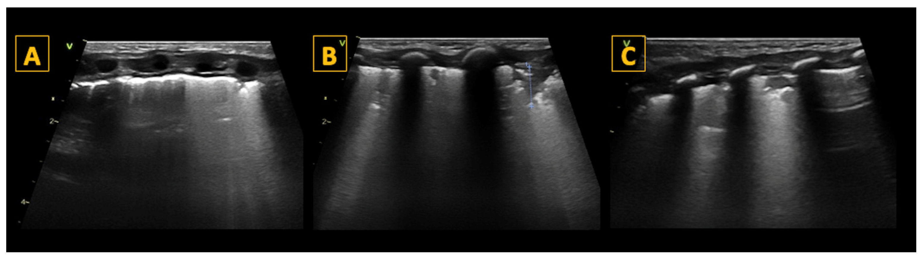 Diagnostics 14 01413 g005