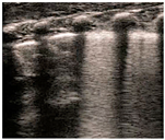 Diagnostics 14 01413 i005