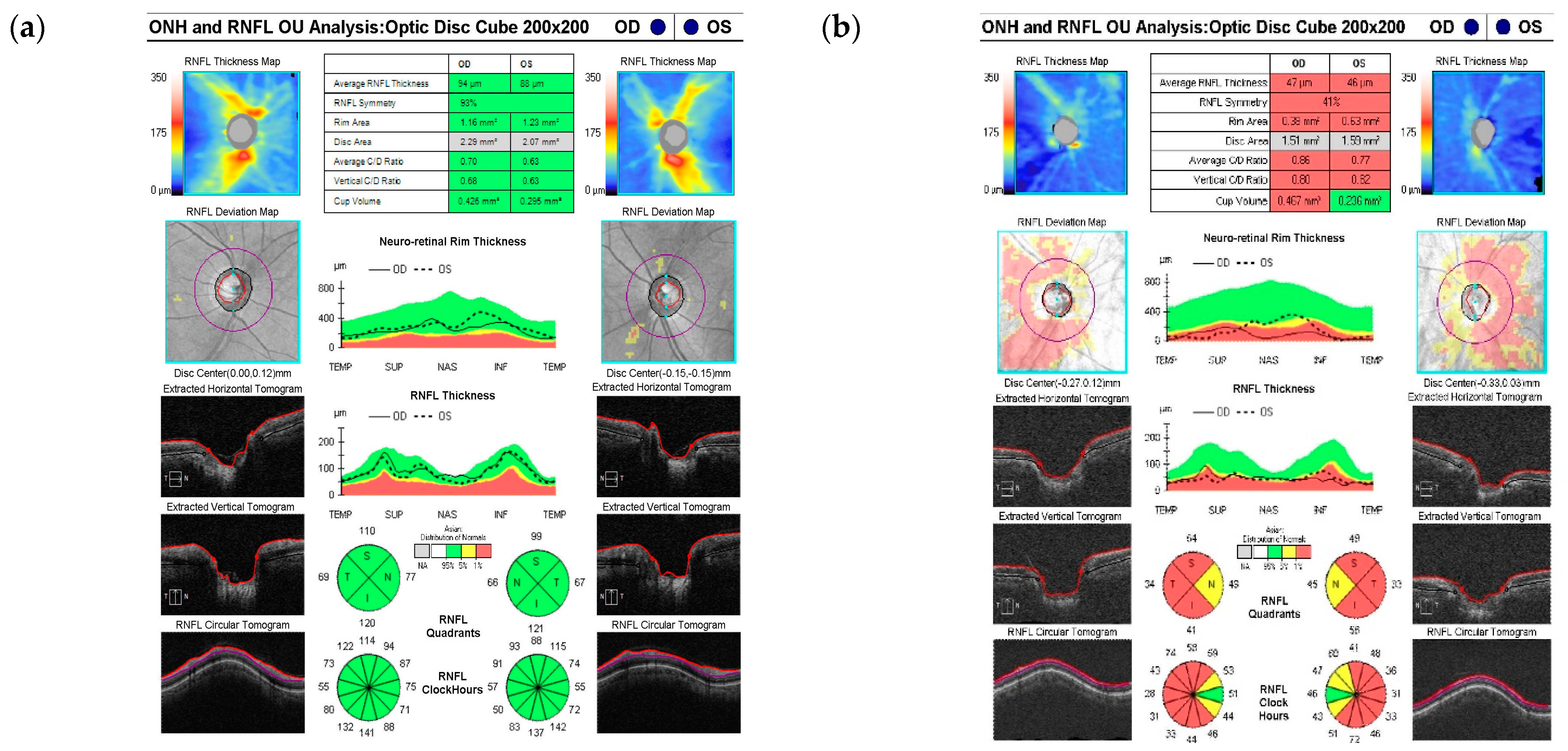 Diagnostics 14 01418 g001