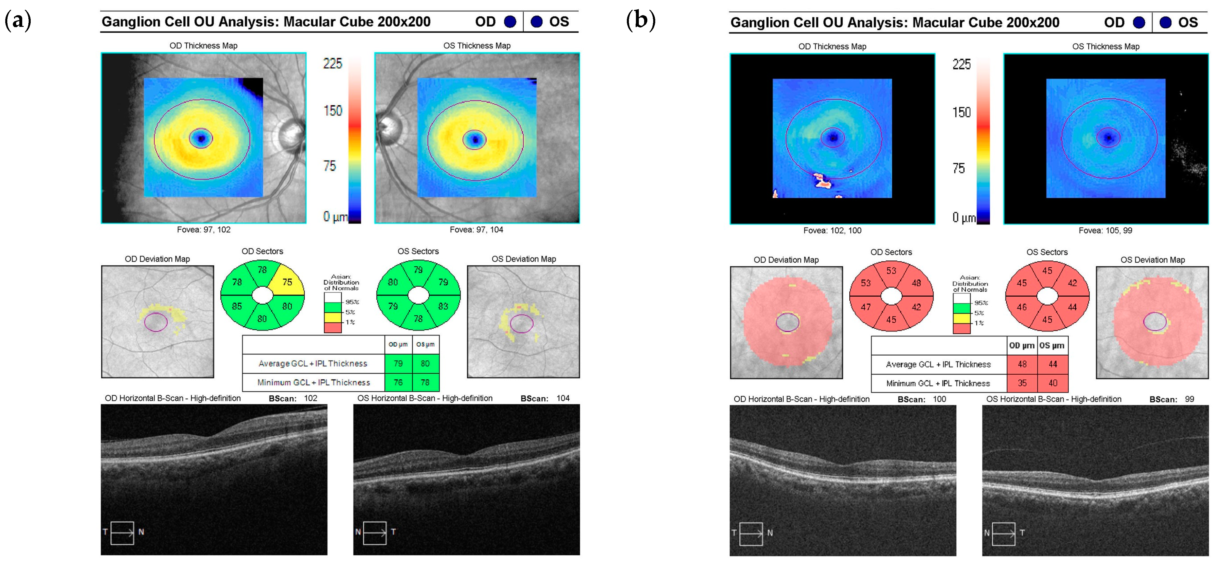 Diagnostics 14 01418 g002