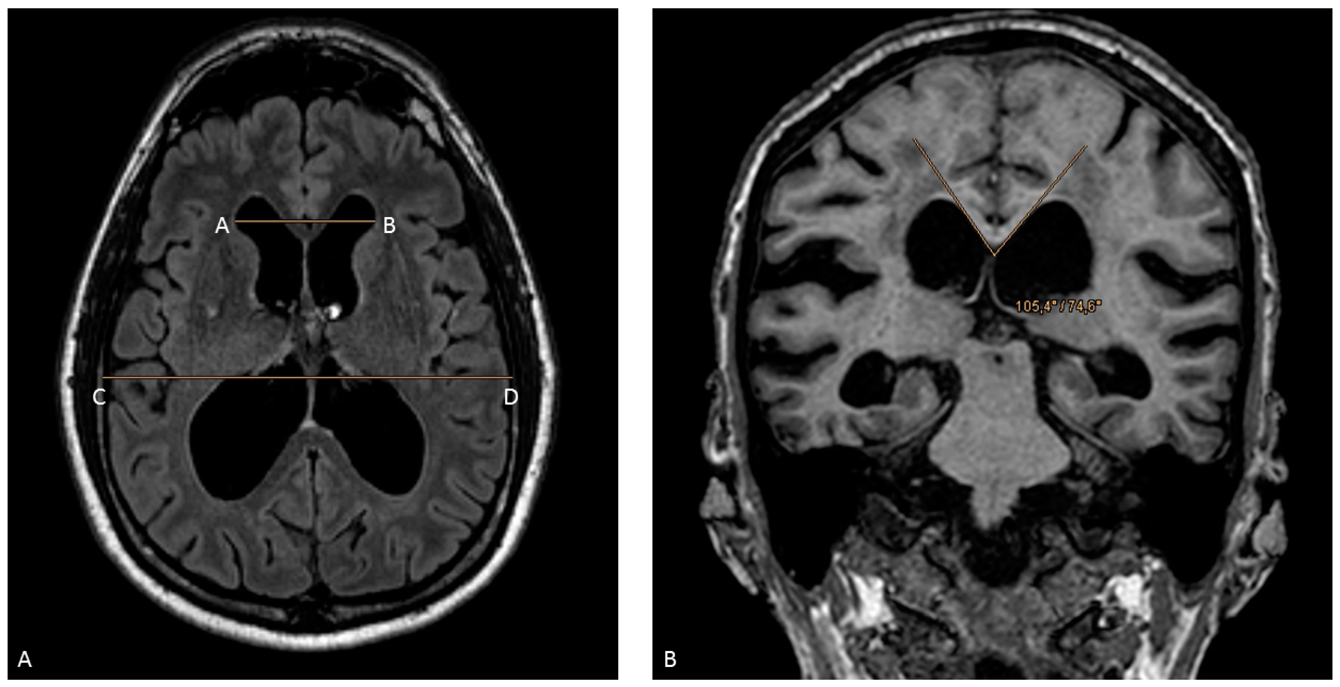 Diagnostics 14 01422 g001