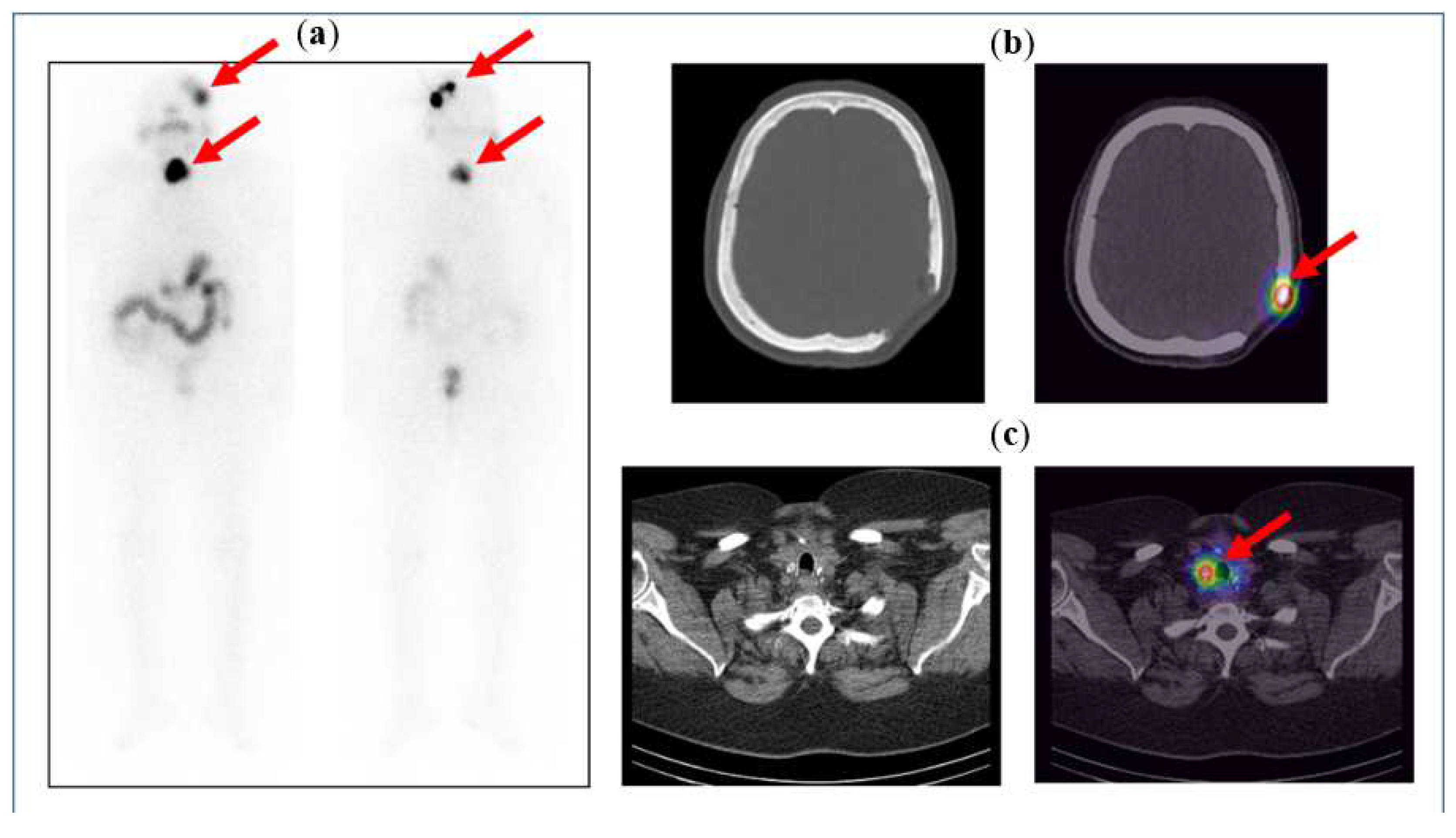 Diagnostics 14 01431 g005