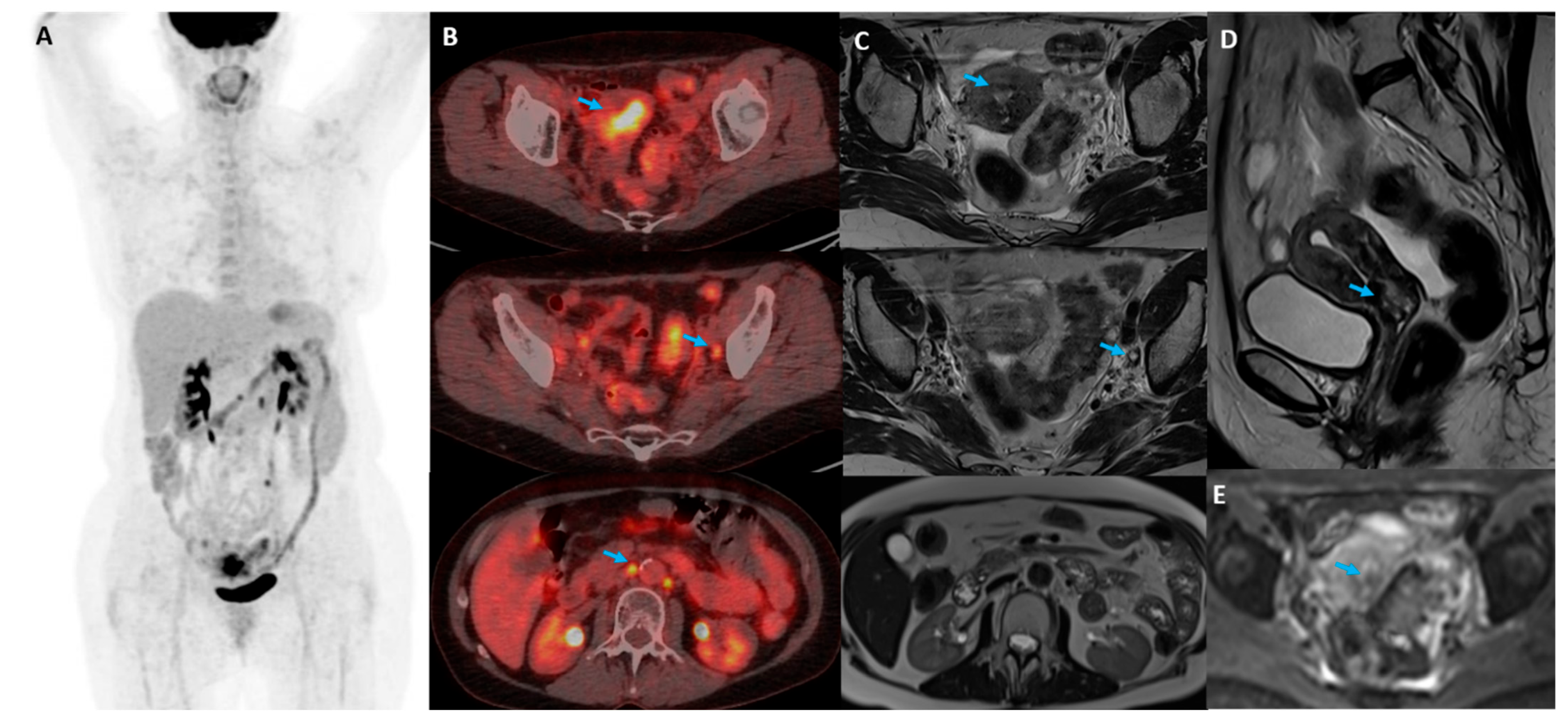 Diagnostics 14 01432 g002