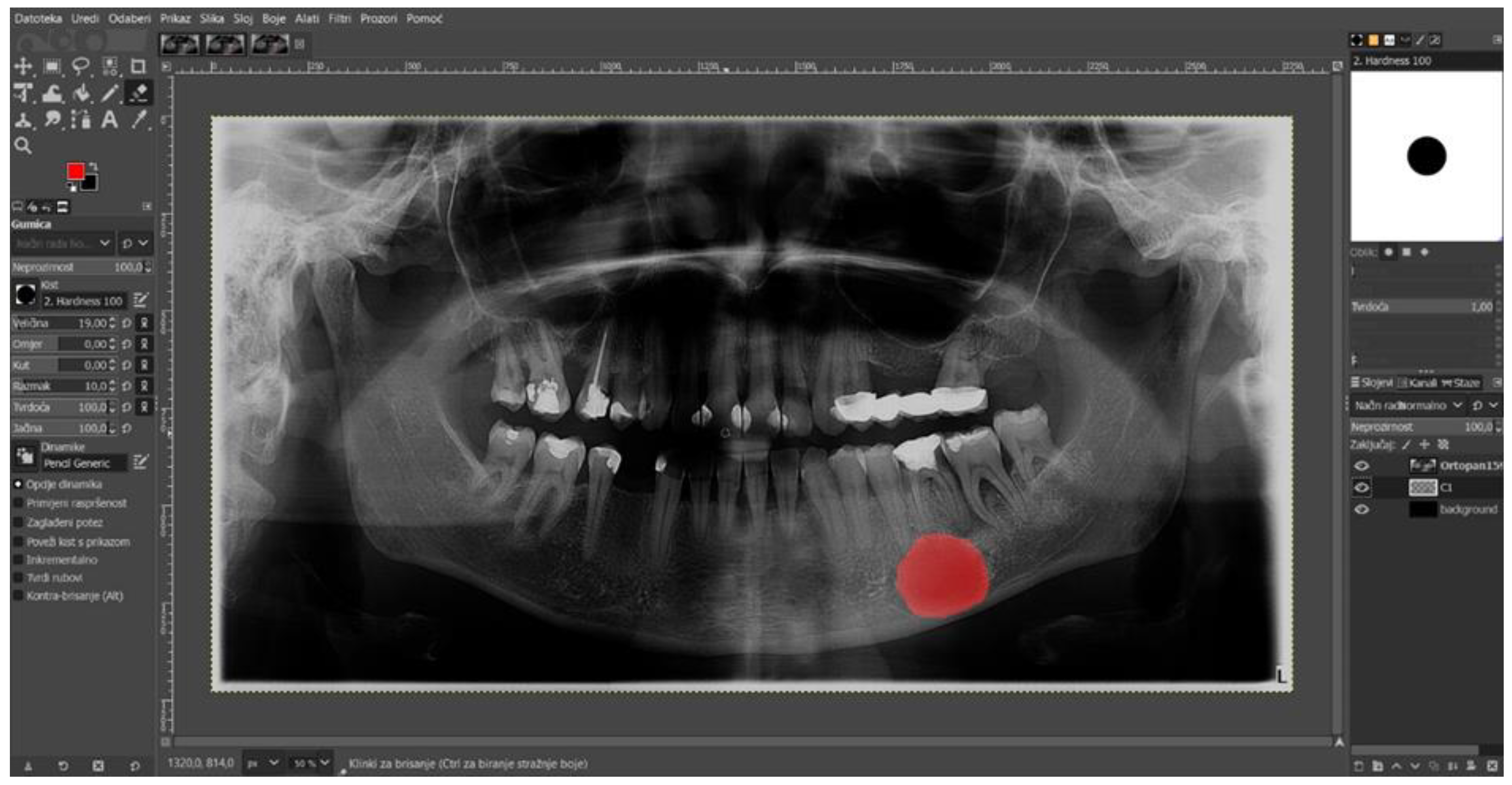 Diagnostics 14 01443 g002