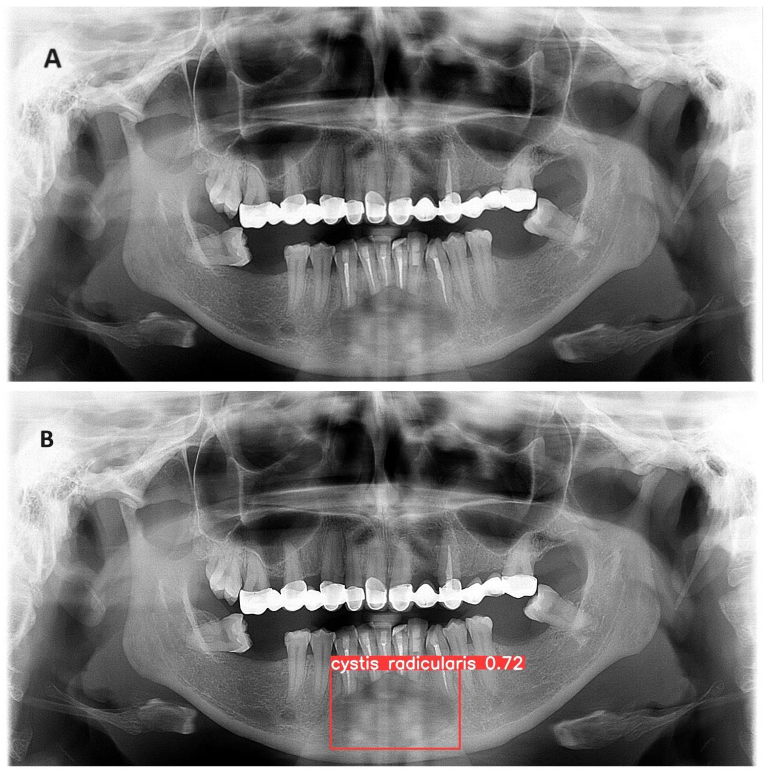 Diagnostics 14 01443 g005