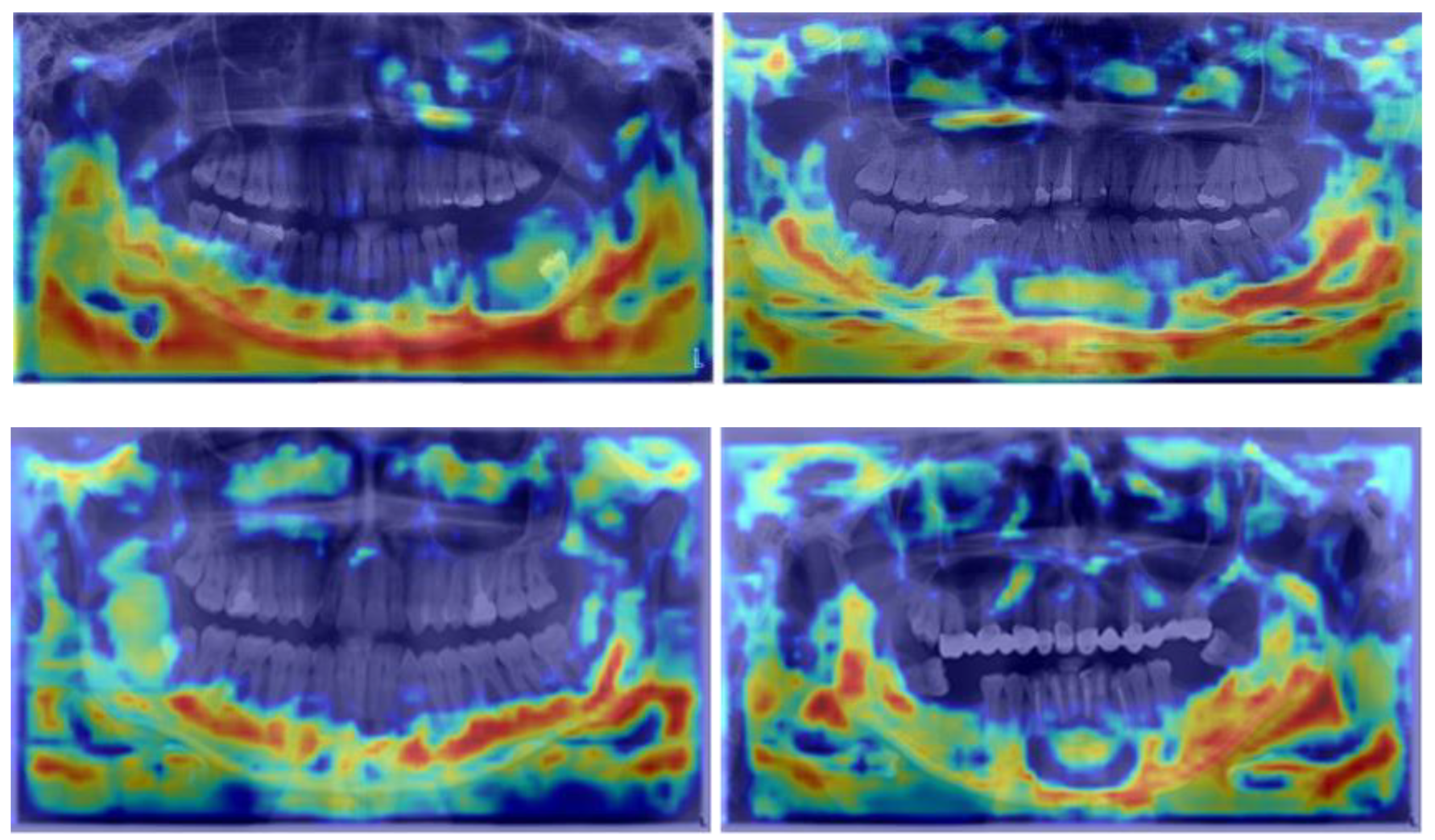 Diagnostics 14 01443 g006