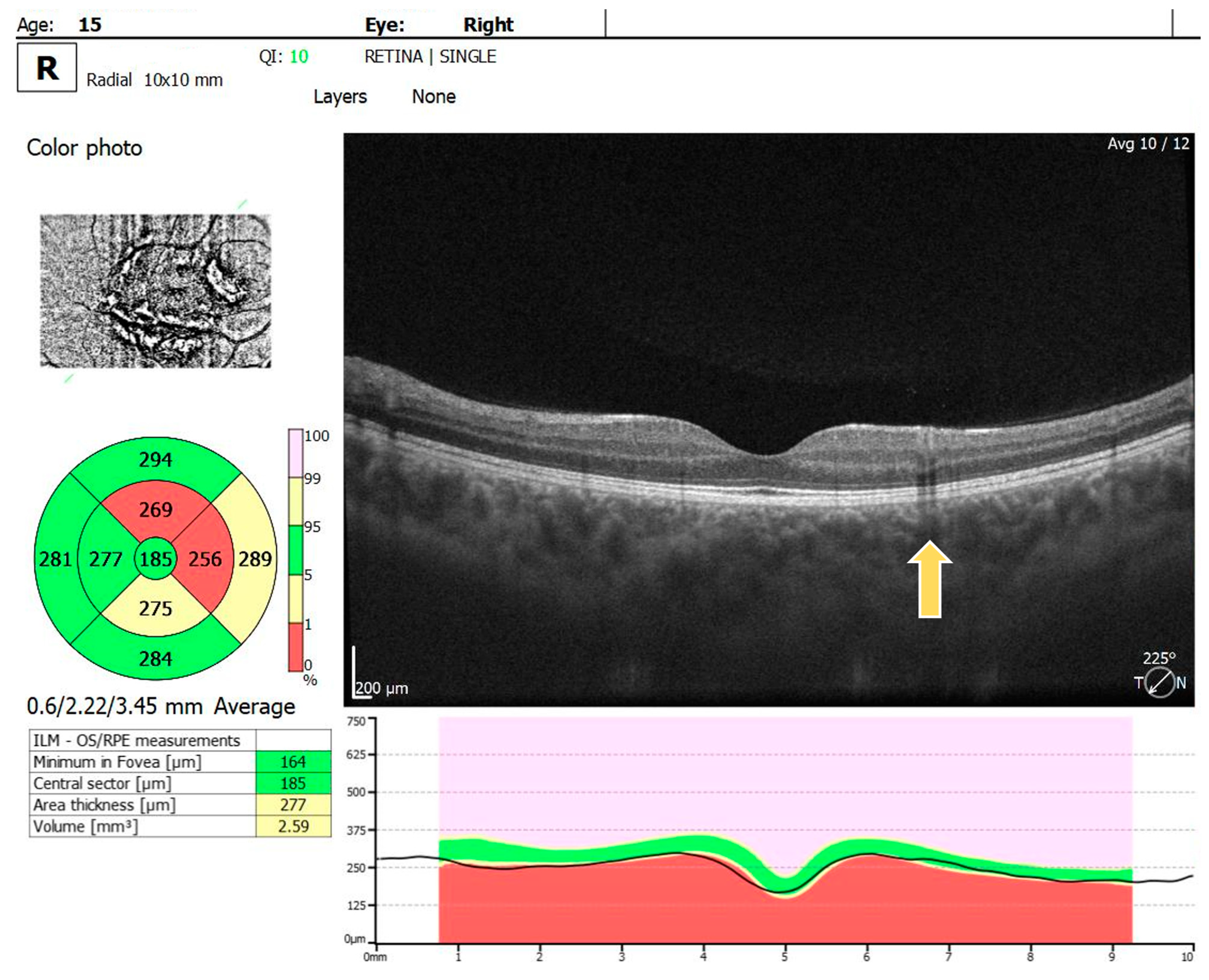 Diagnostics 14 01447 g002