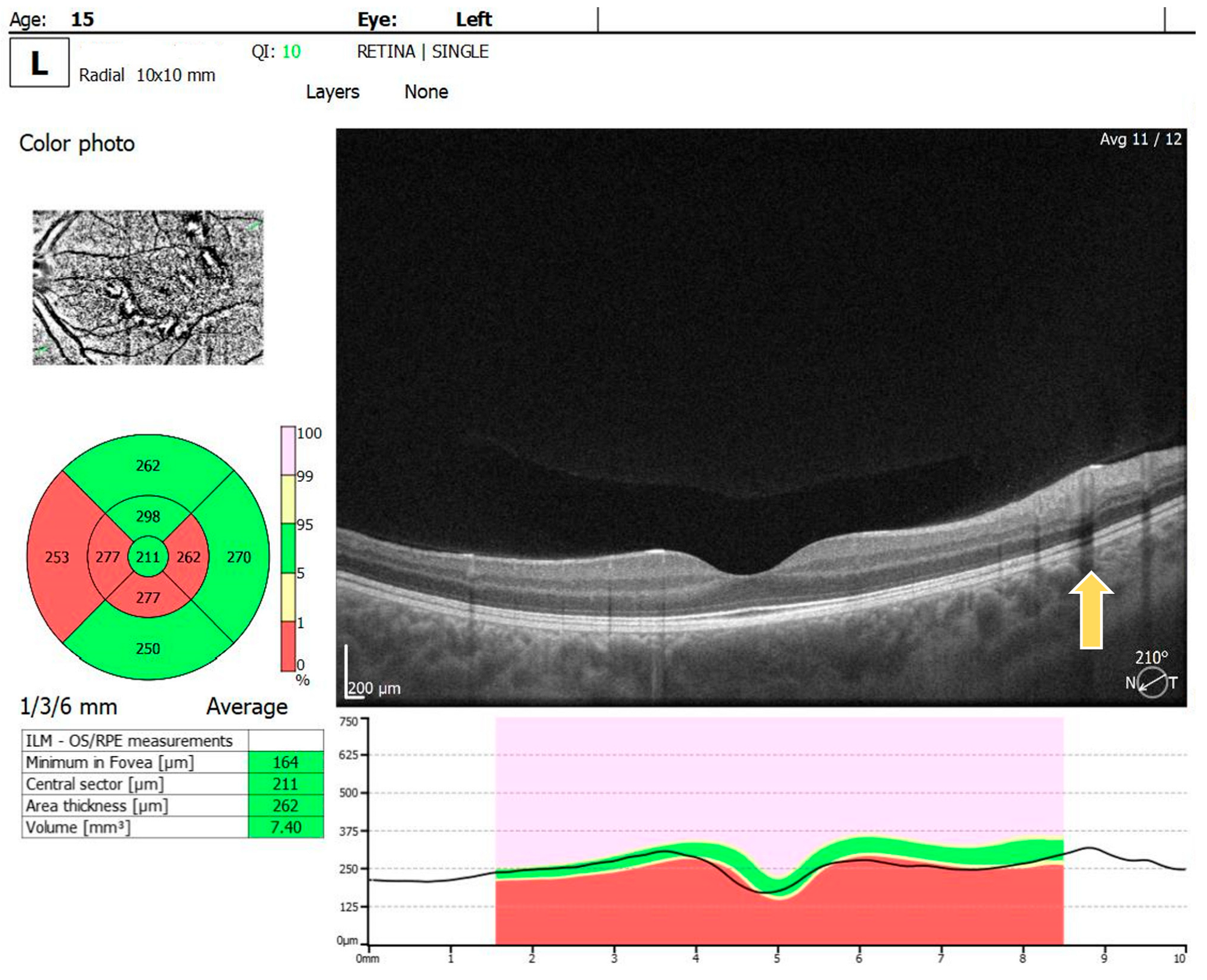 Diagnostics 14 01447 g003