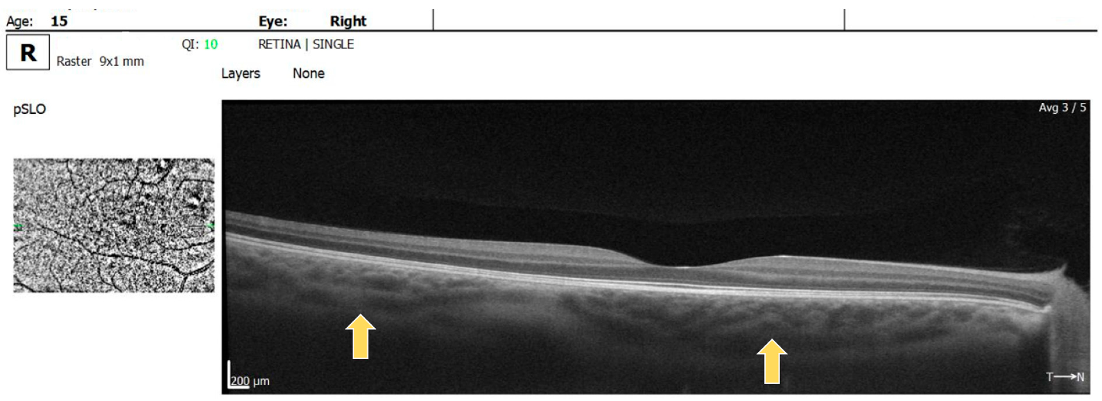 Diagnostics 14 01447 g004a