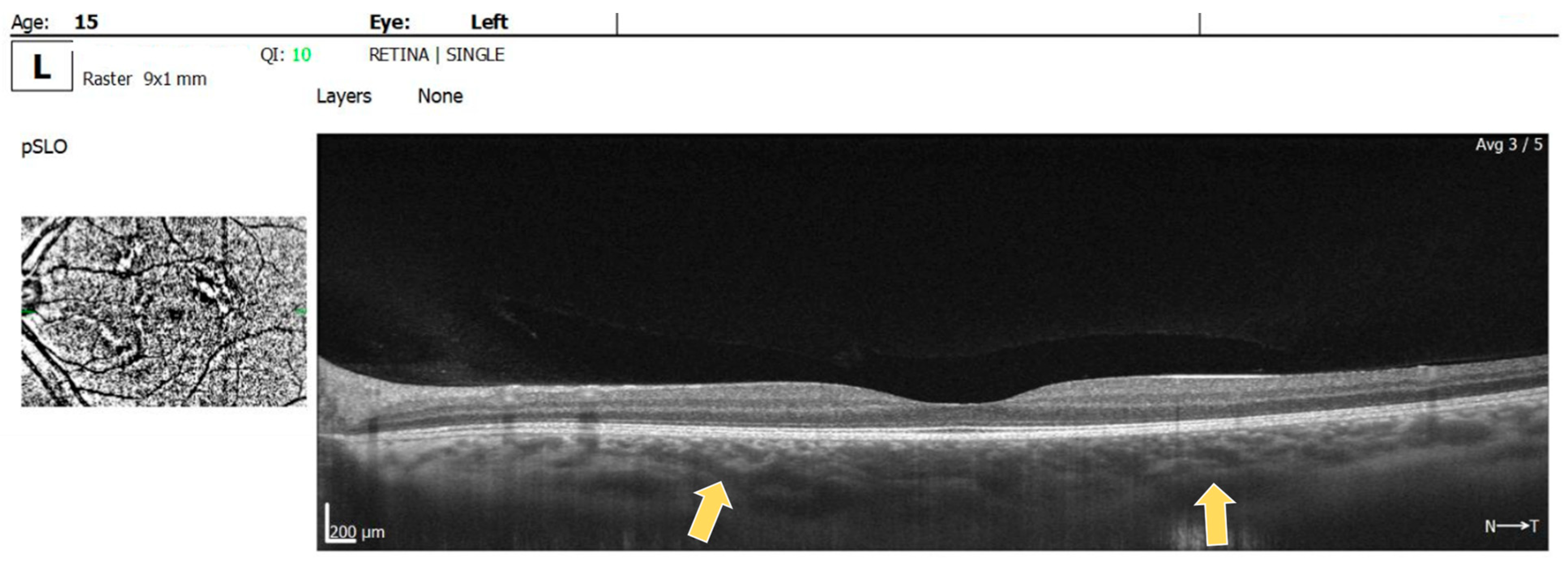 Diagnostics 14 01447 g004b