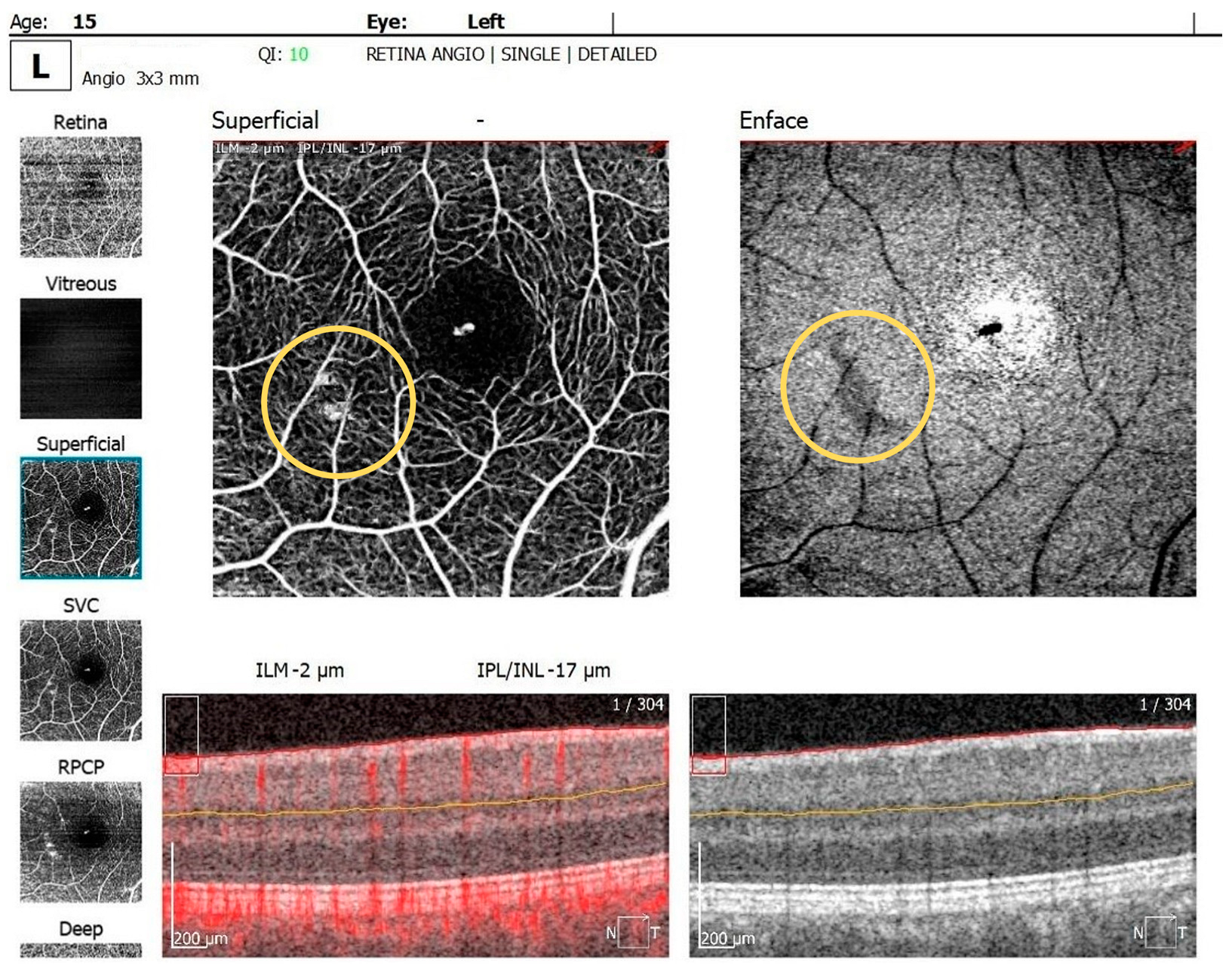 Diagnostics 14 01447 g005b