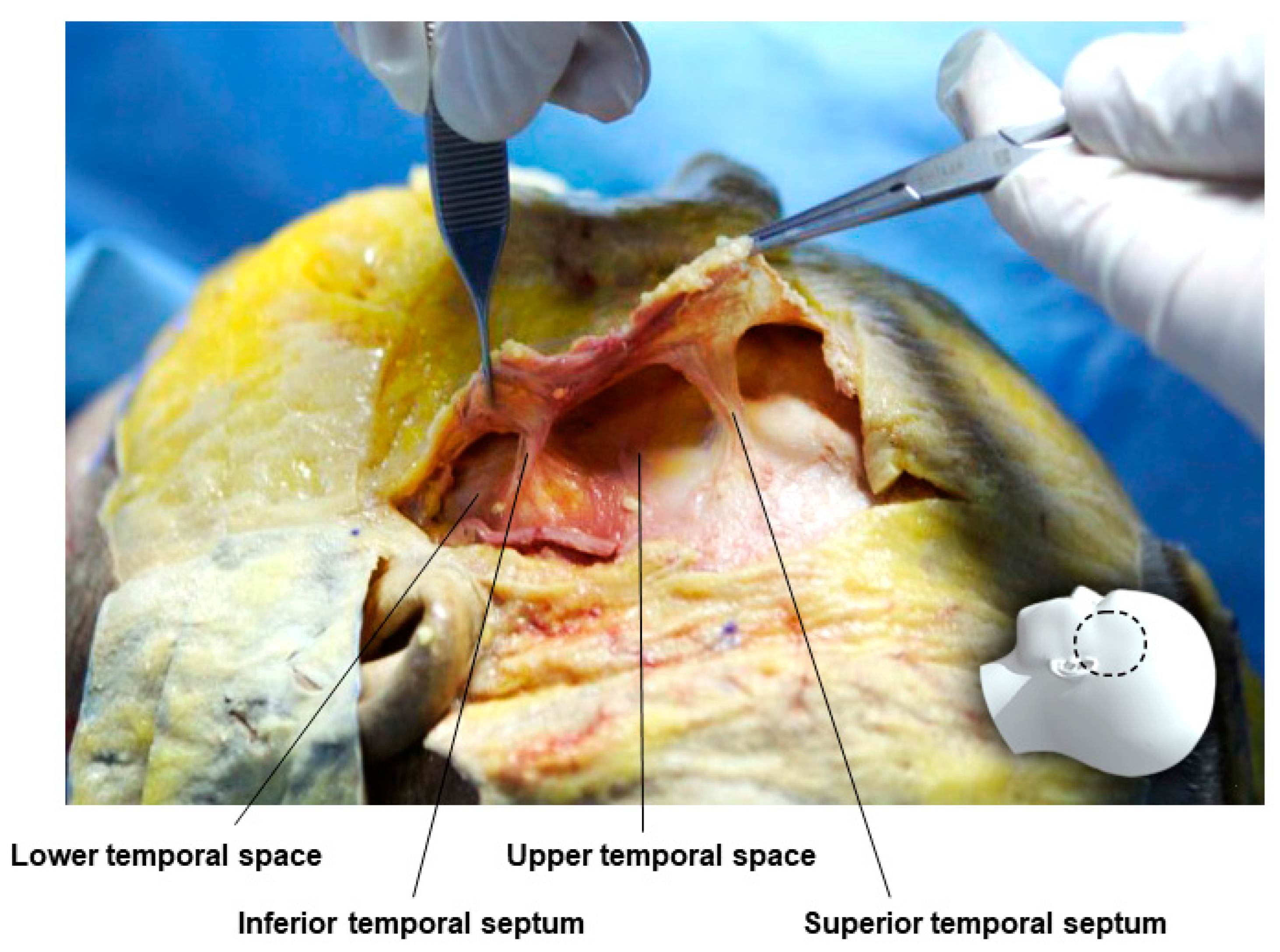 Diagnostics 14 01452 g004