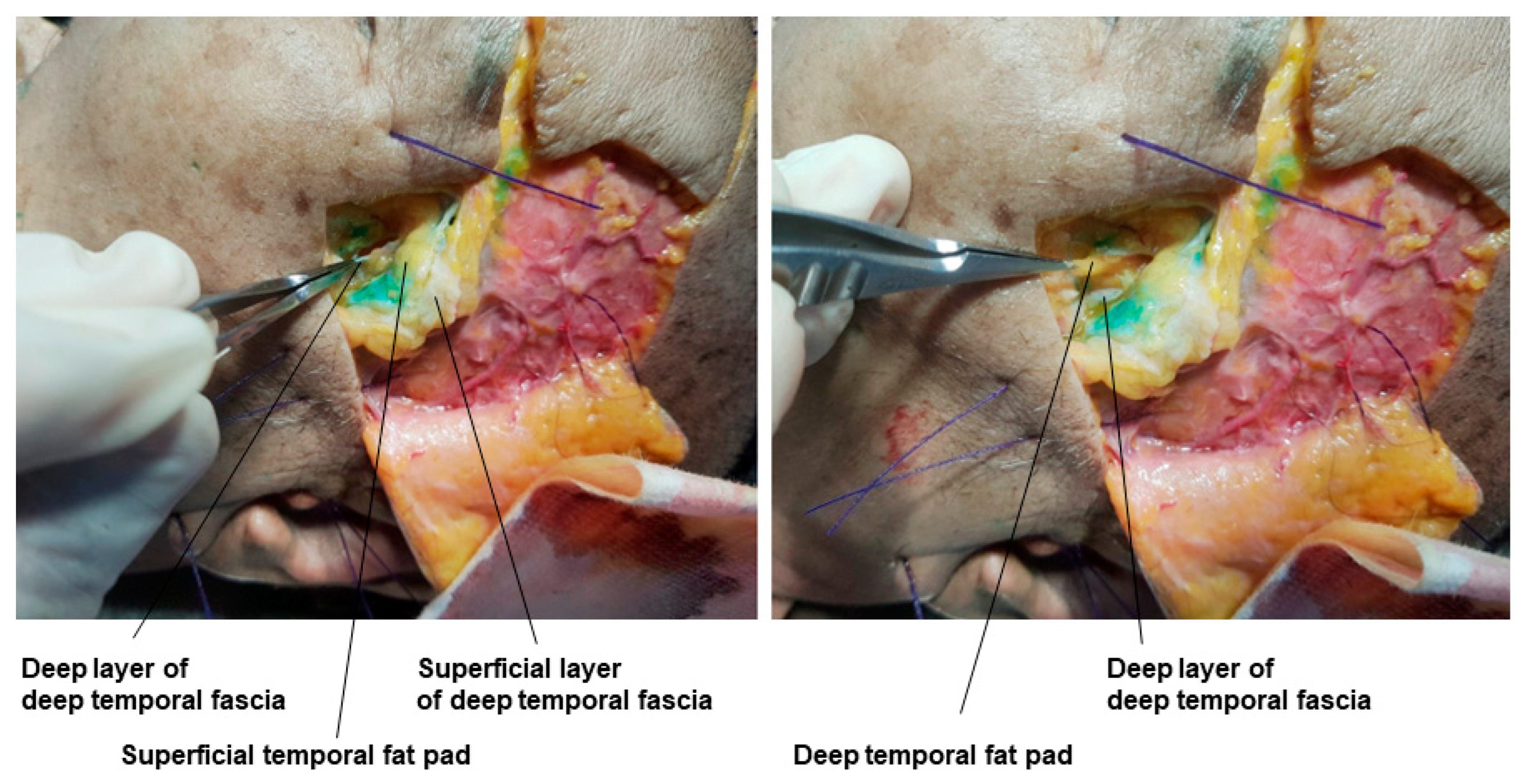Diagnostics 14 01452 g008