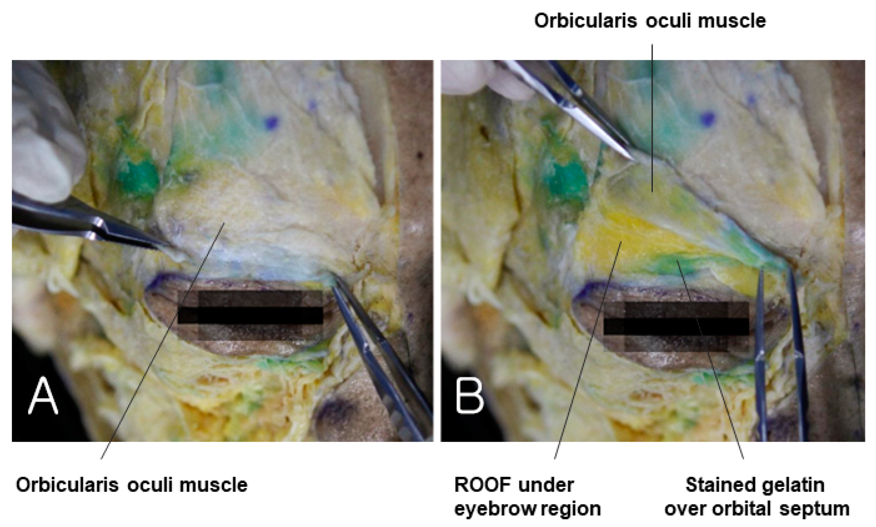 Diagnostics 14 01452 g011