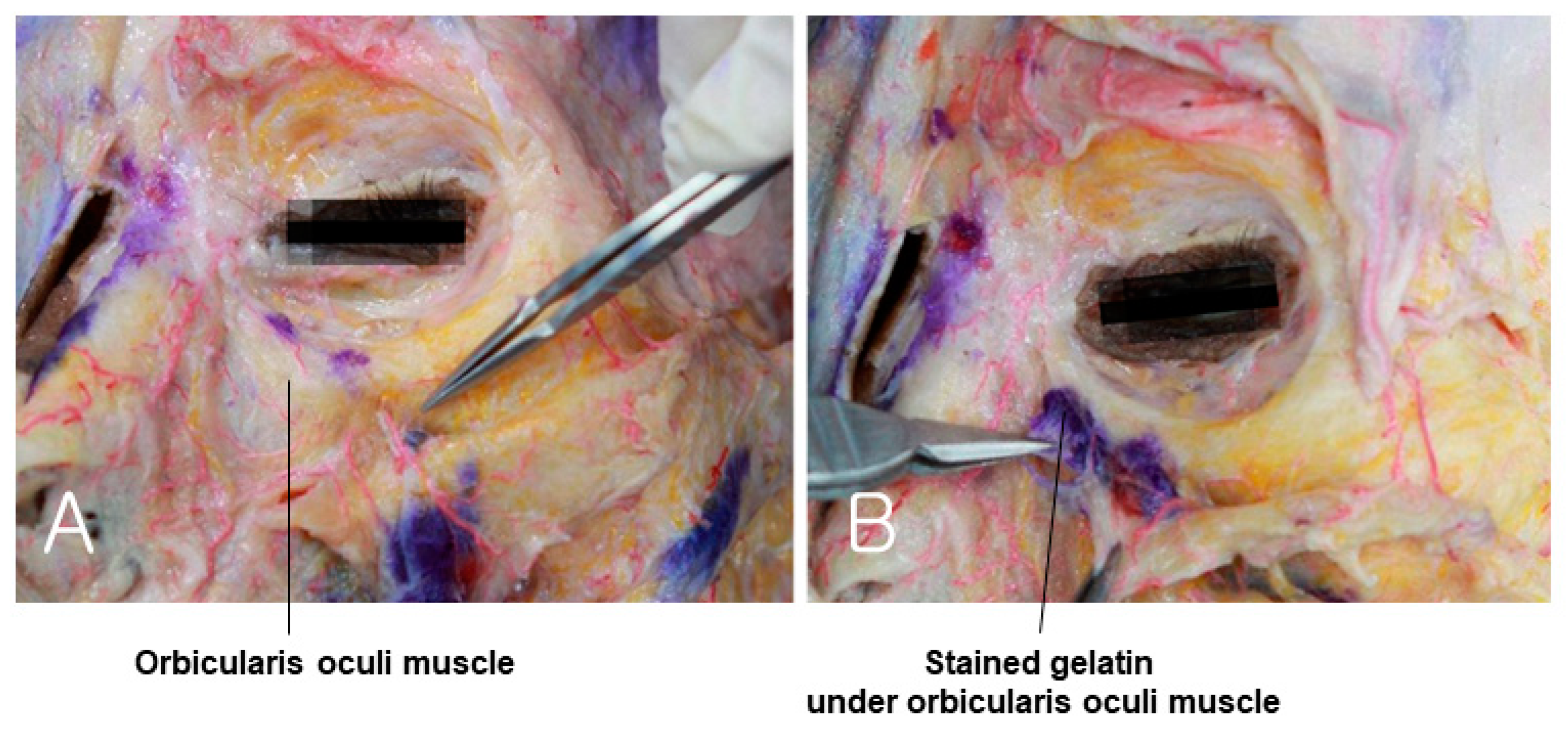 Diagnostics 14 01452 g012