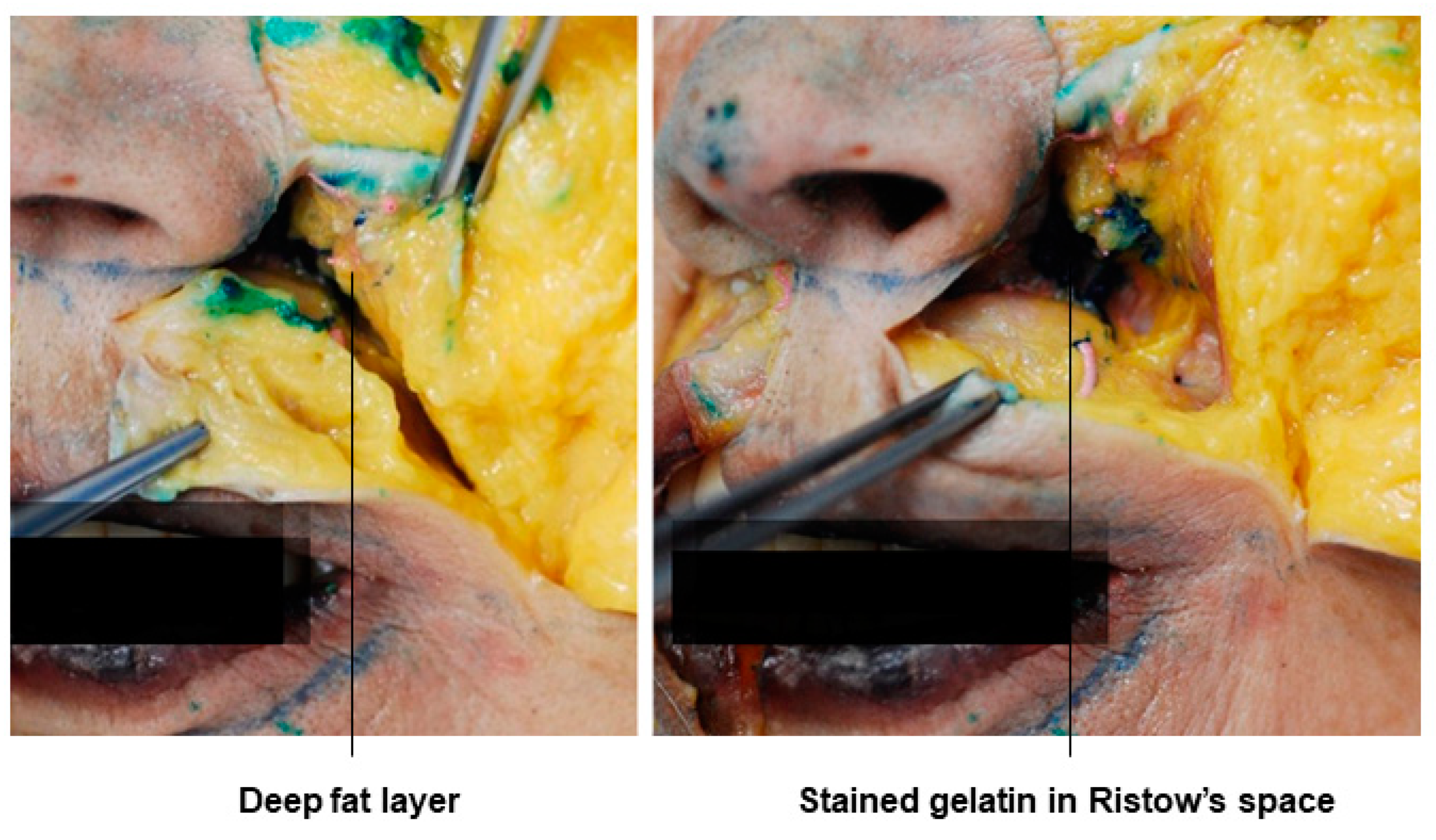 Diagnostics 14 01452 g015