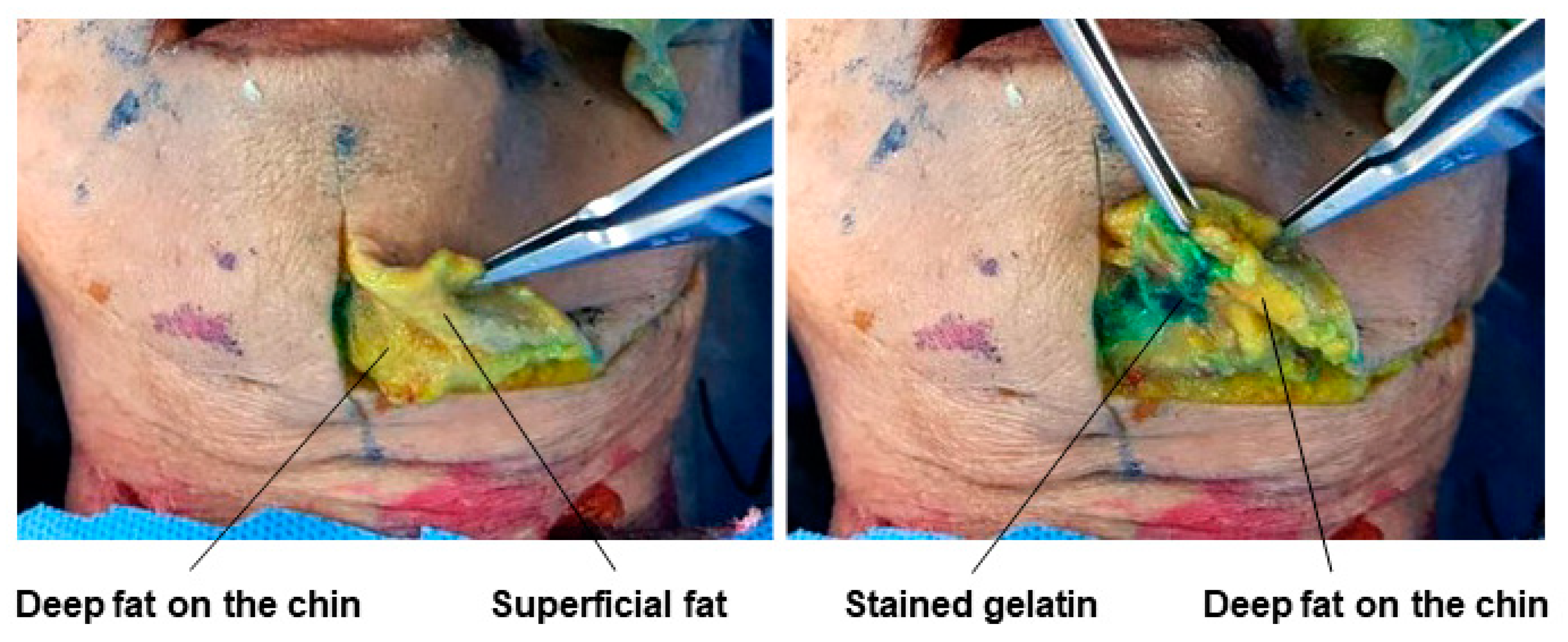 Diagnostics 14 01452 g023