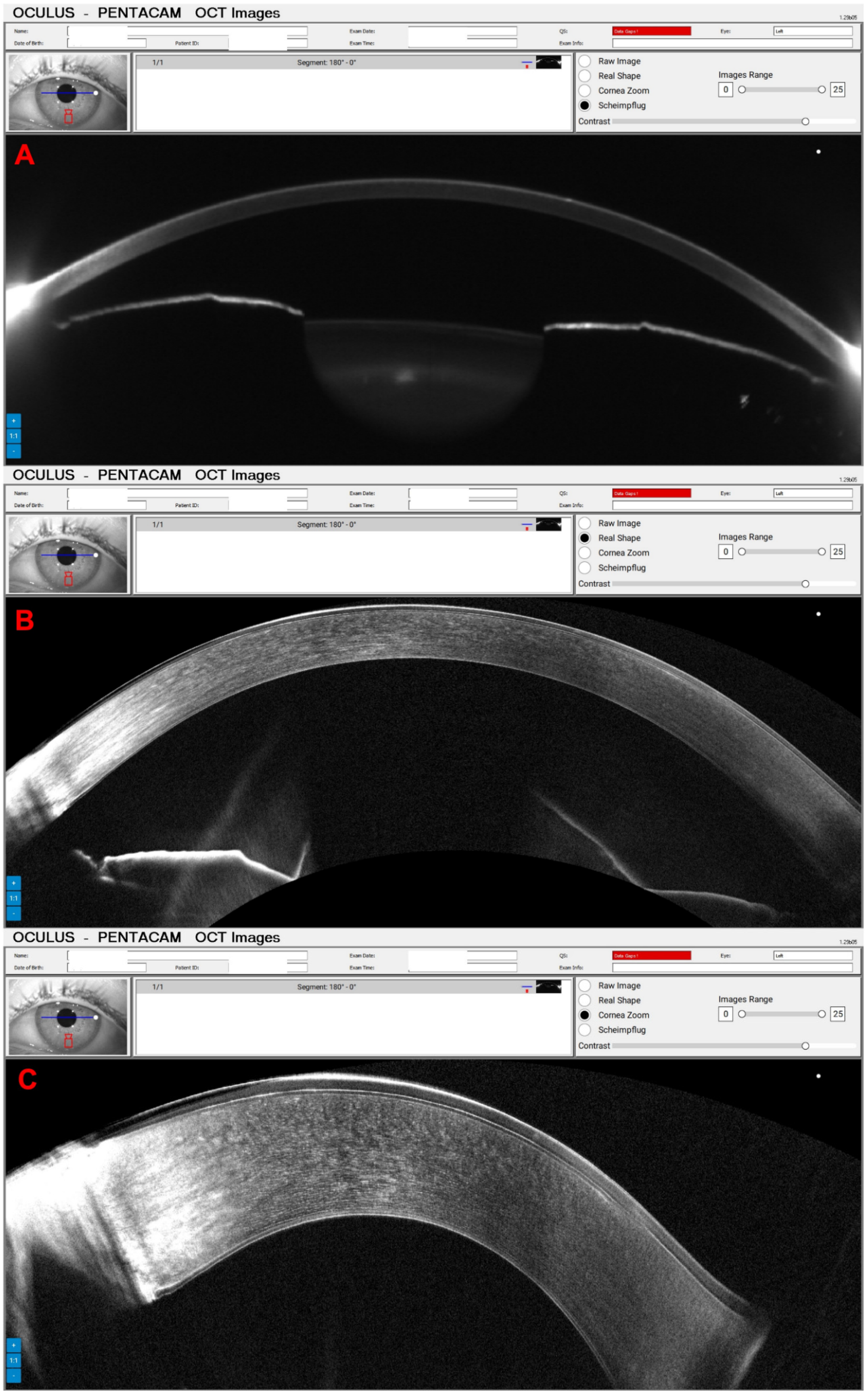 Diagnostics 14 01455 g004