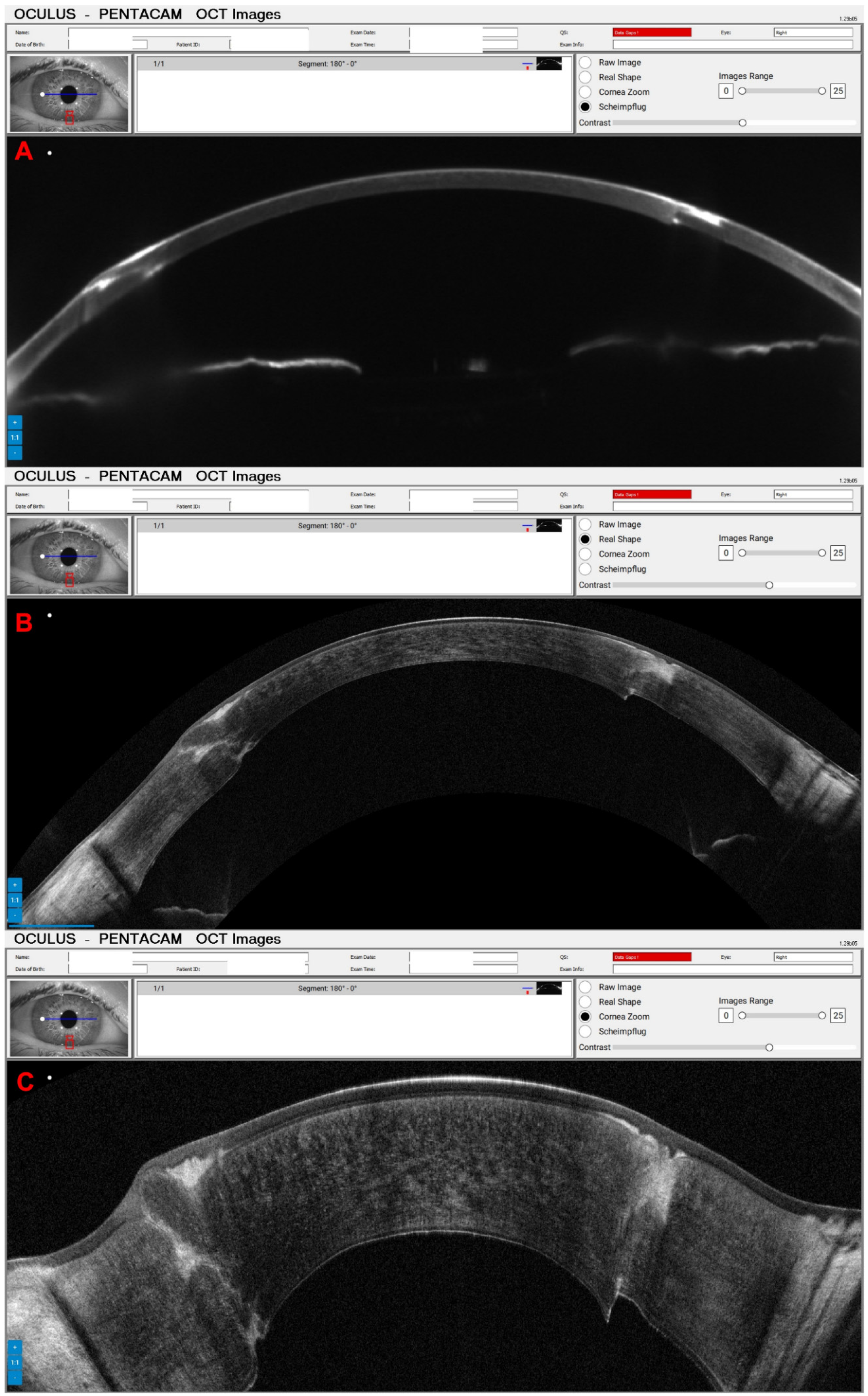 Diagnostics 14 01455 g008