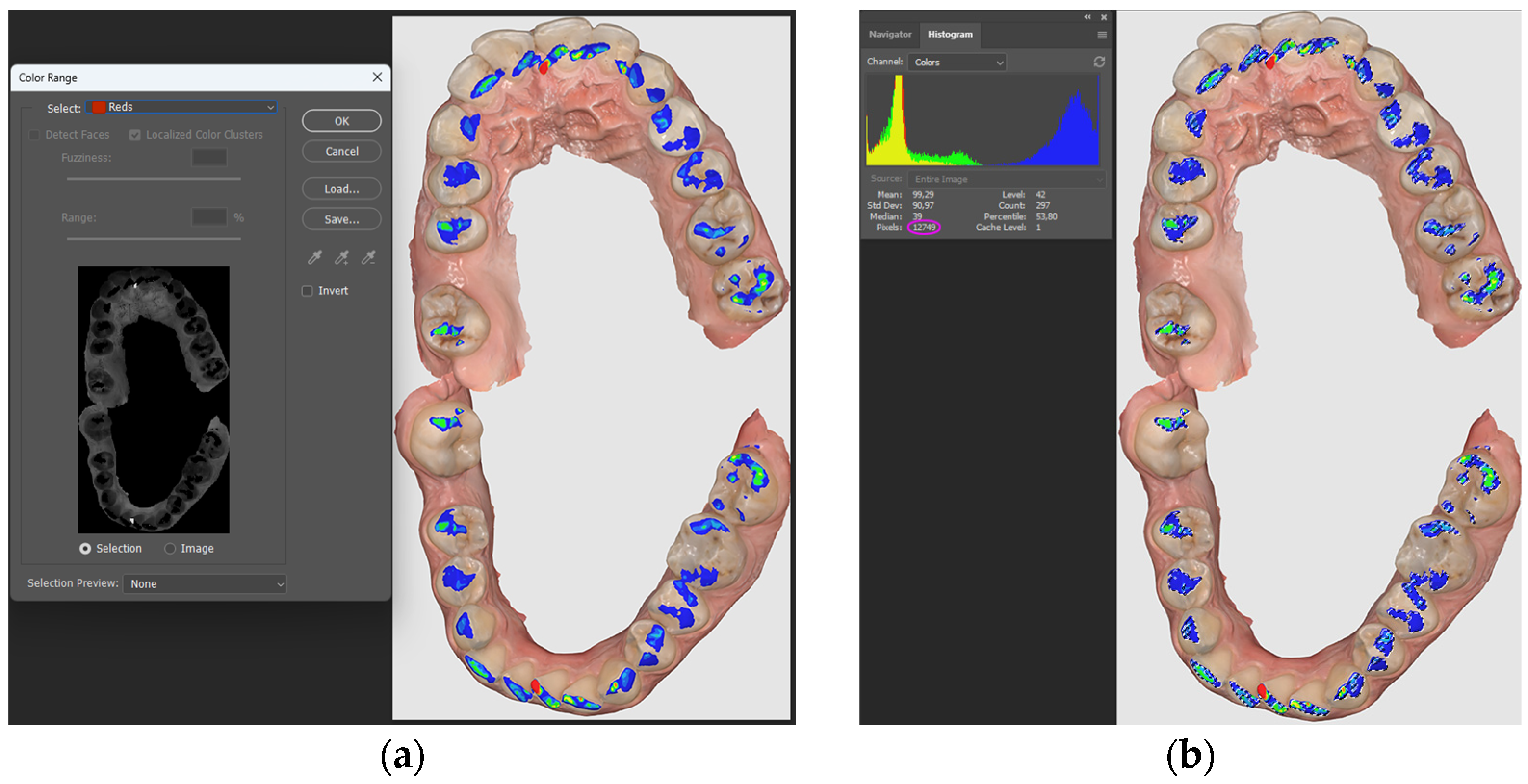 Diagnostics 14 01457 g001