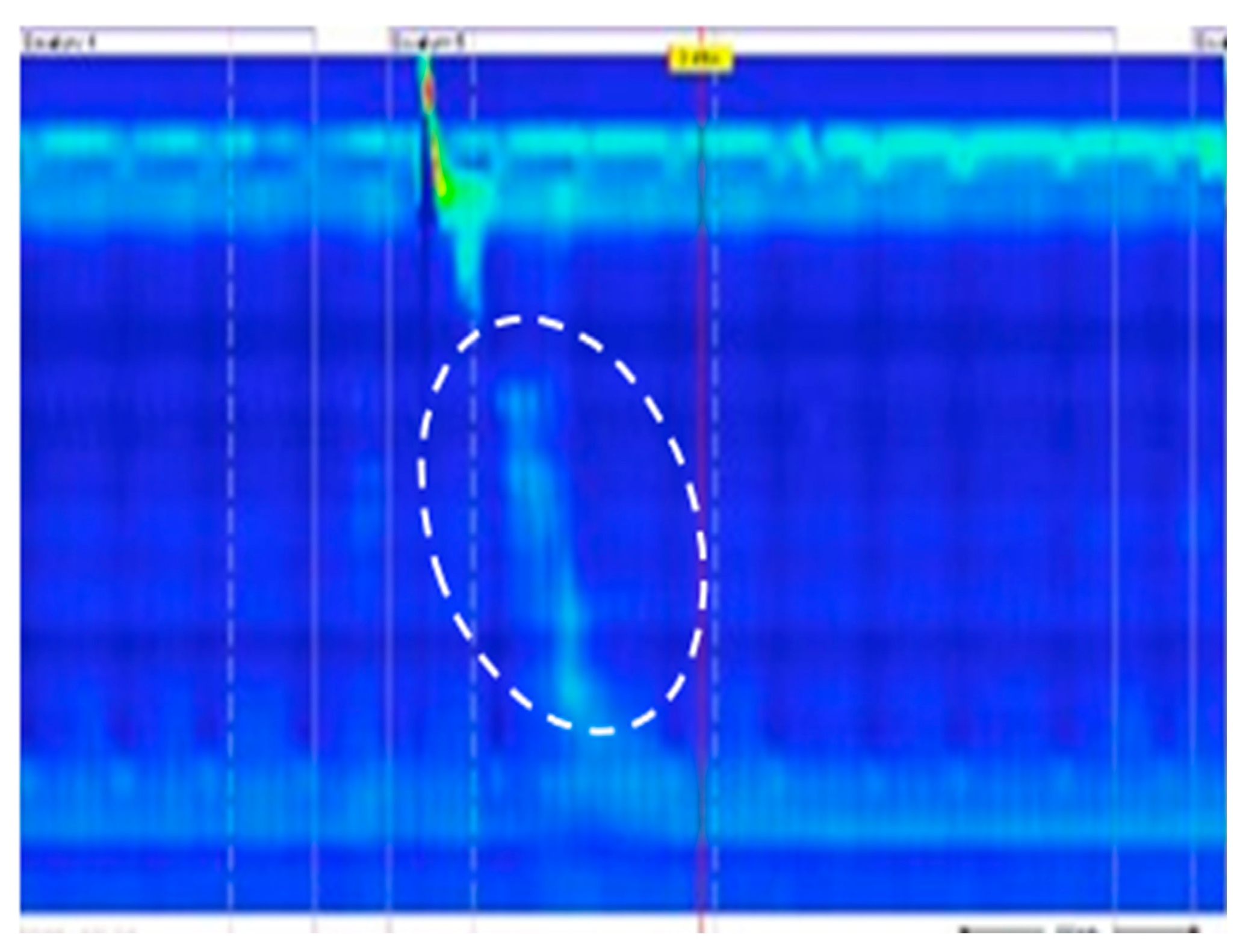 Diagnostics 14 01467 g004 Diagnostics 14 01467 g004