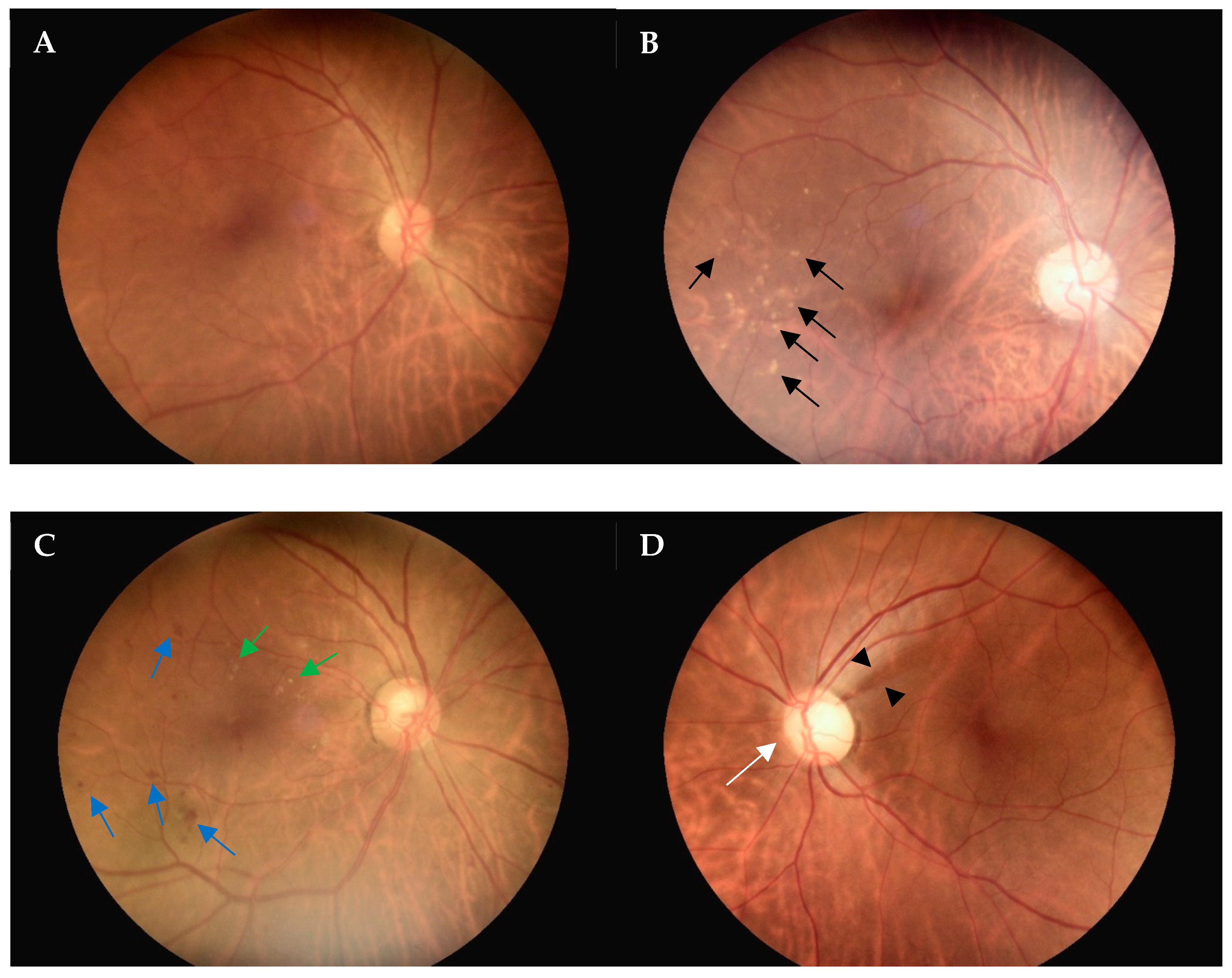 Diagnostics 14 01543 g004
