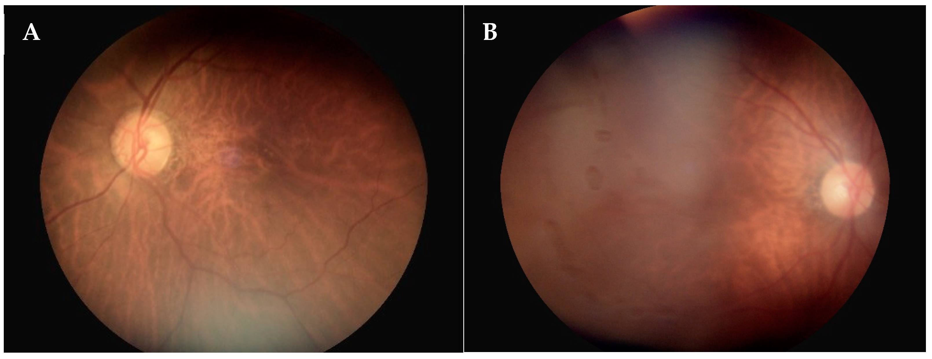 Diagnostics 14 01543 g005