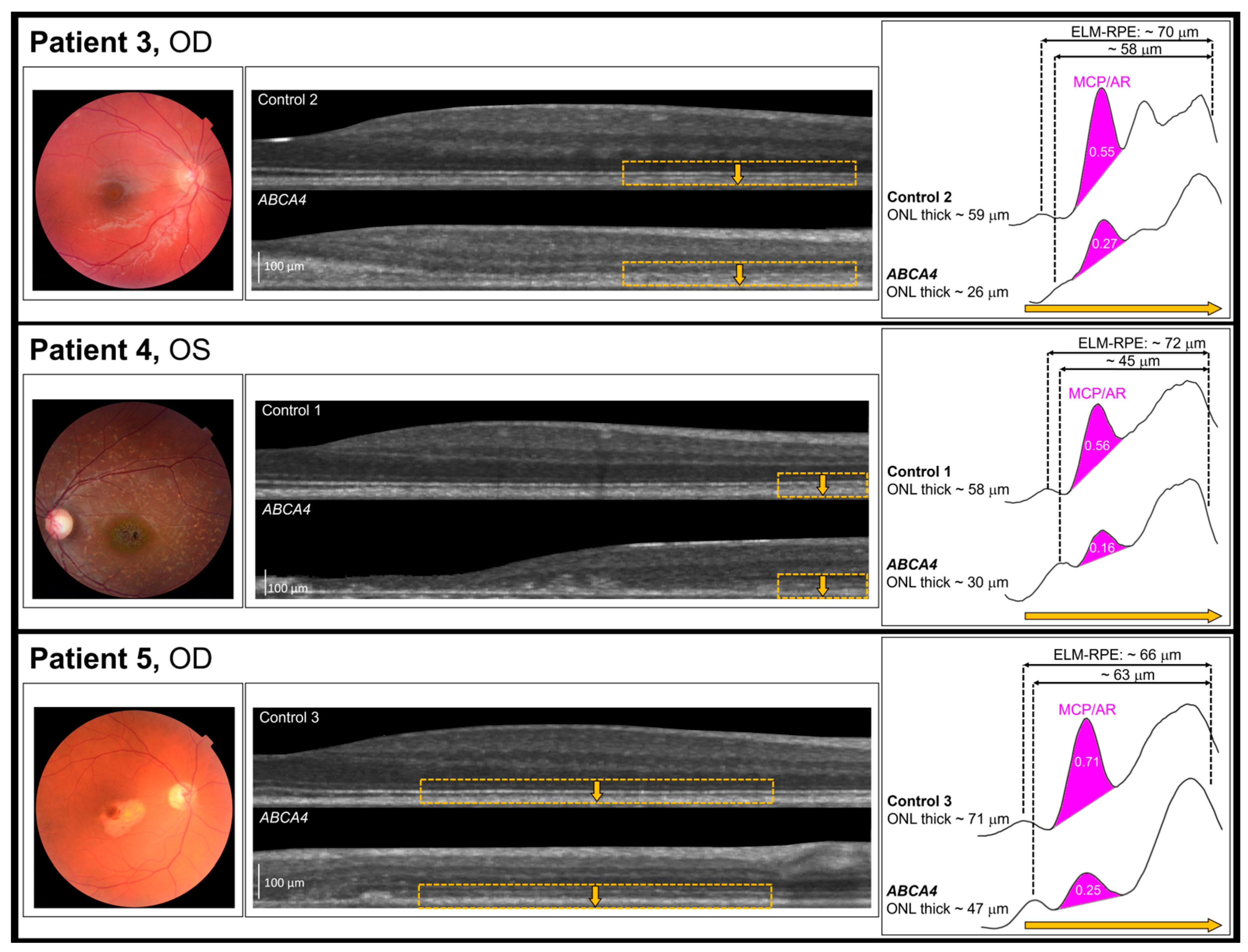 Diagnostics 14 01545 g004