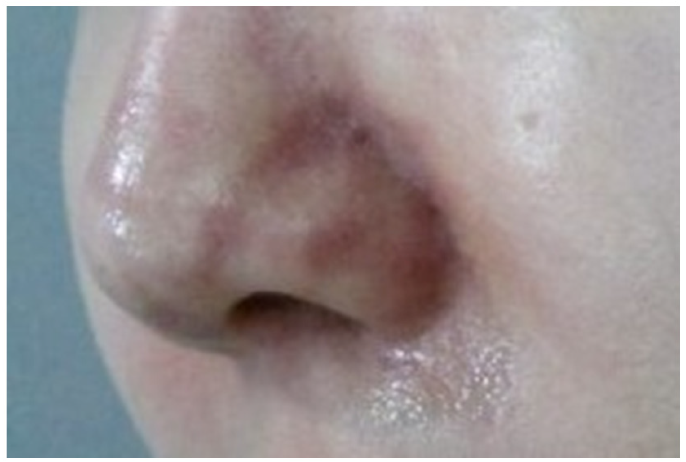 Diagnostics 14 01555 g001