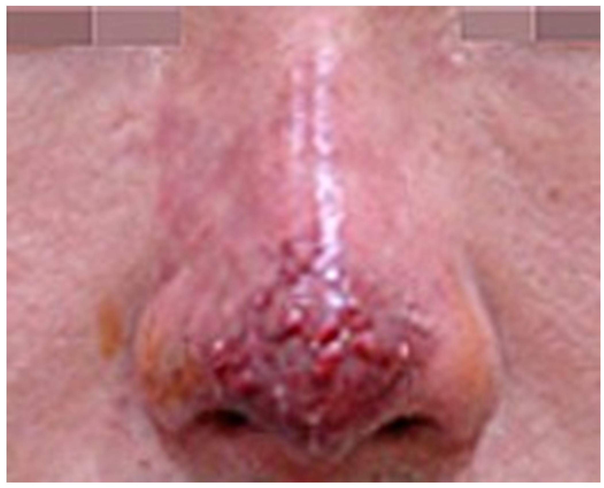 Diagnostics 14 01555 g002