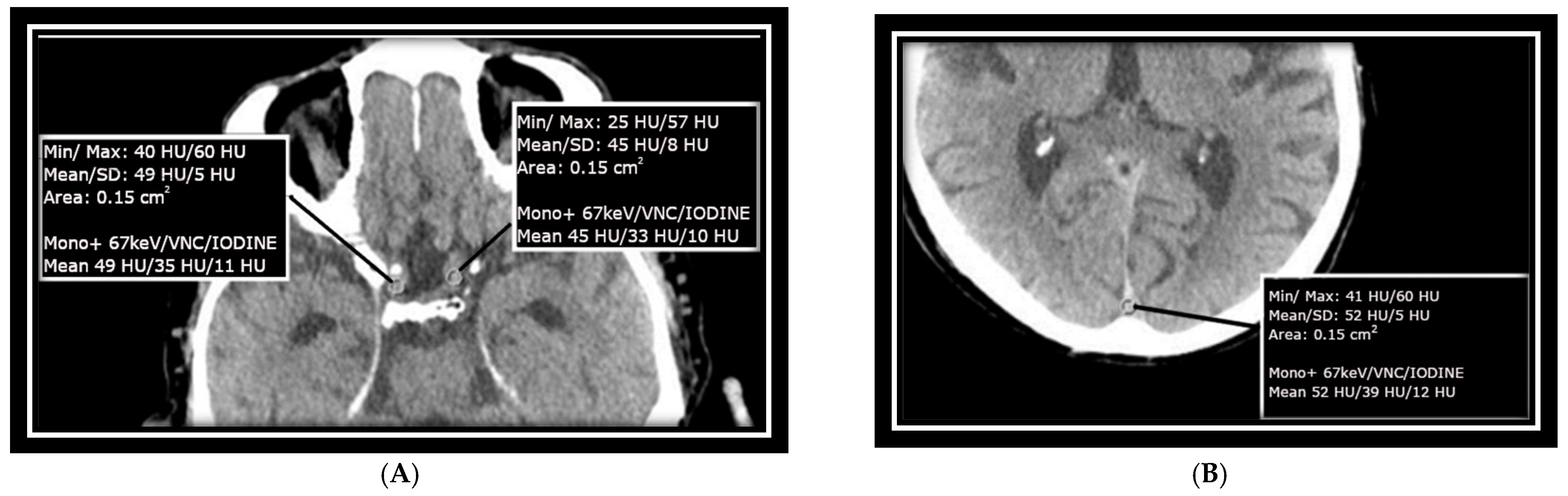Diagnostics 14 01561 g001