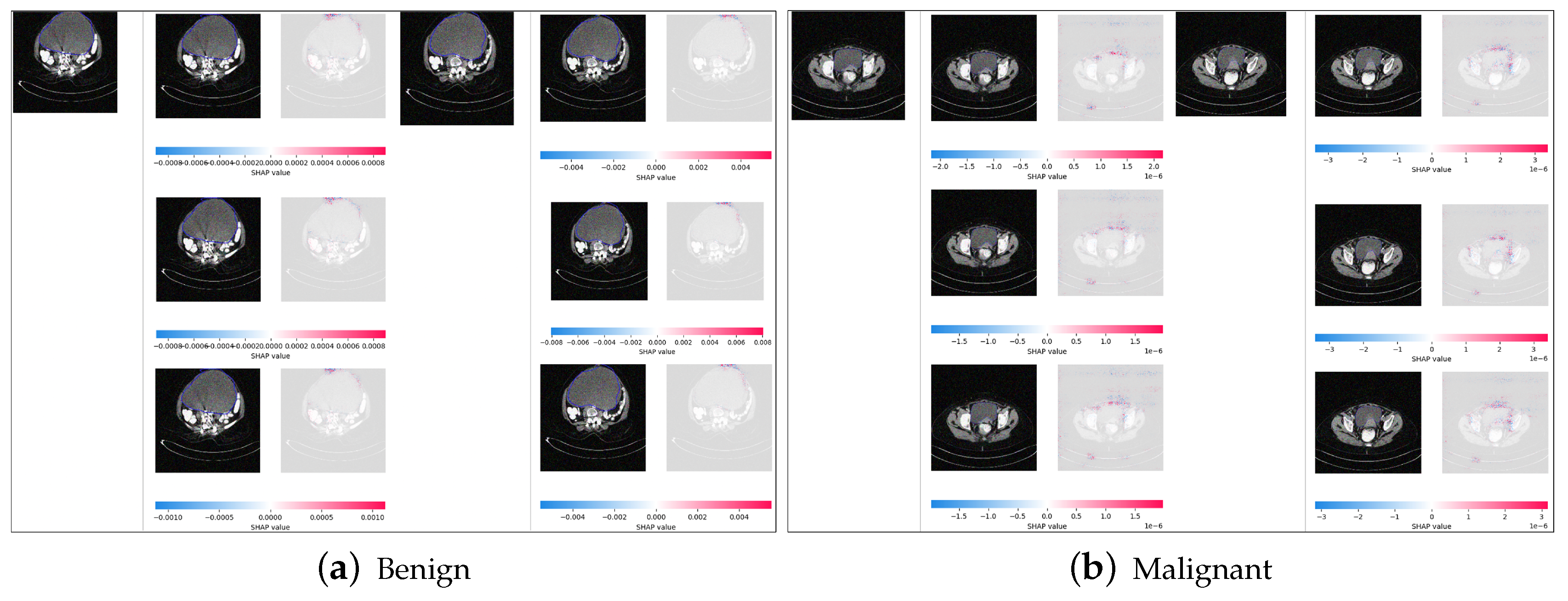 Diagnostics 14 01567 g014