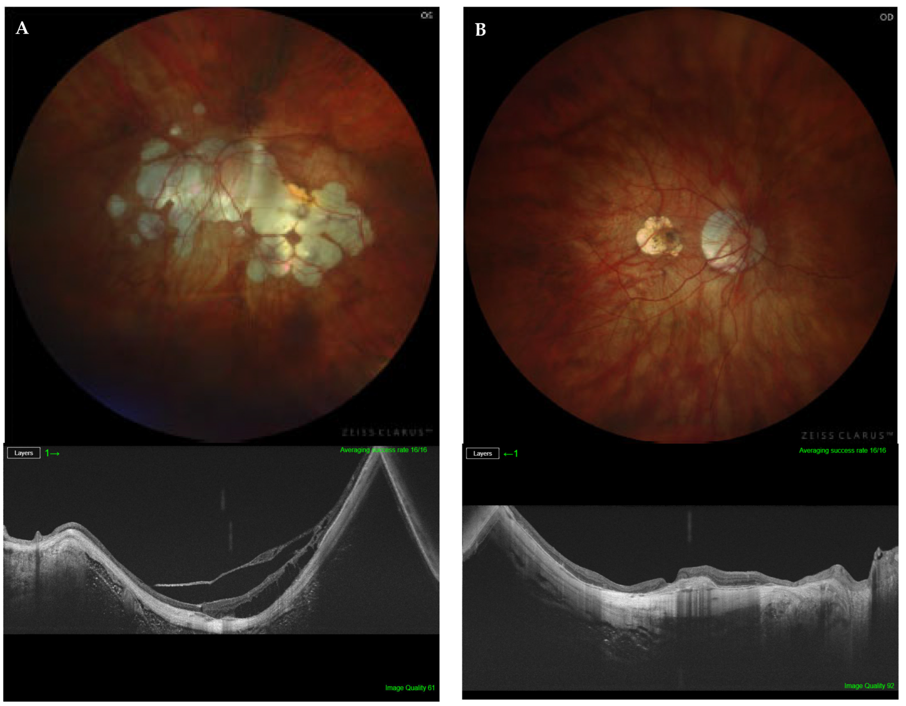 Diagnostics 14 01581 g001