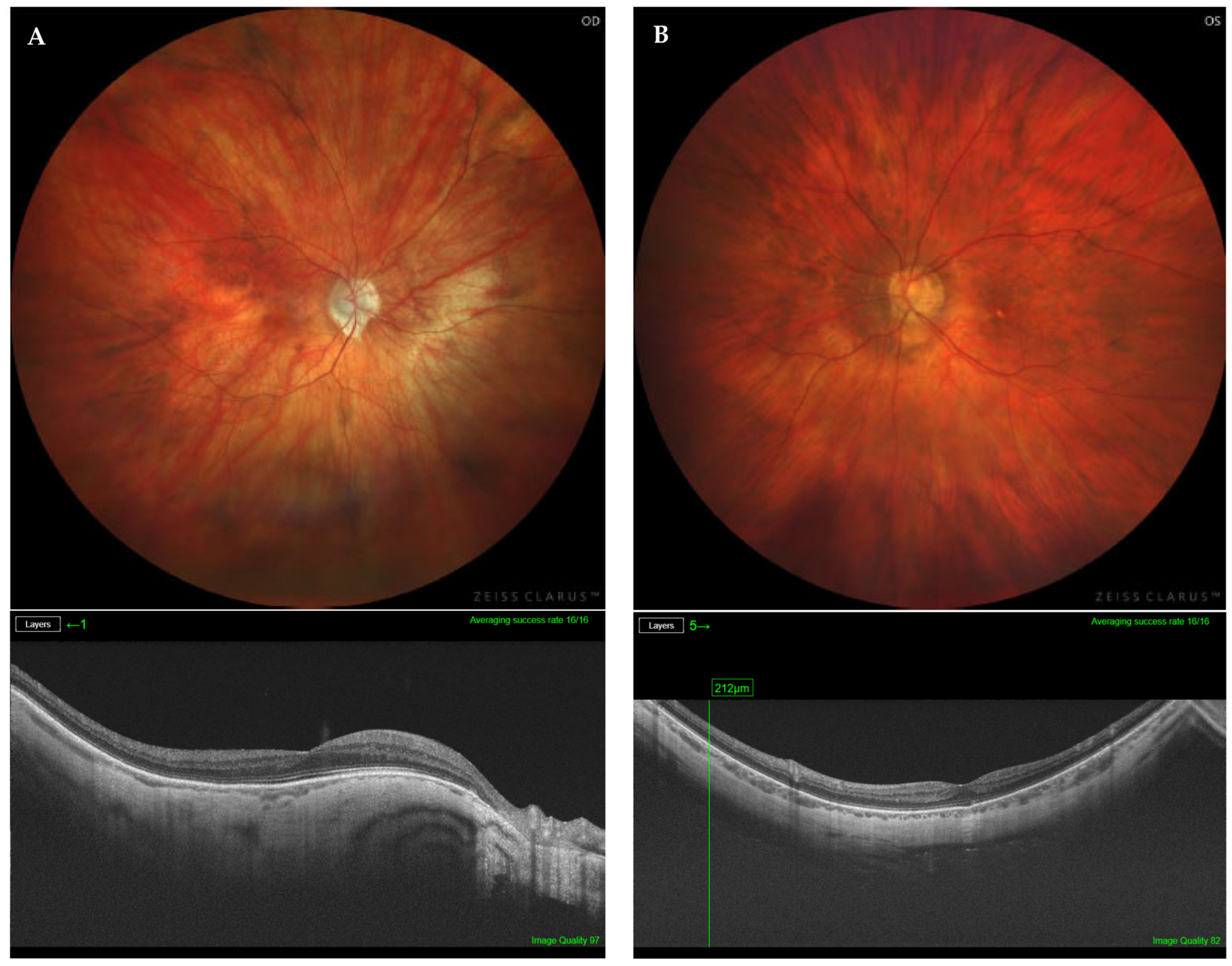 Diagnostics 14 01581 g002