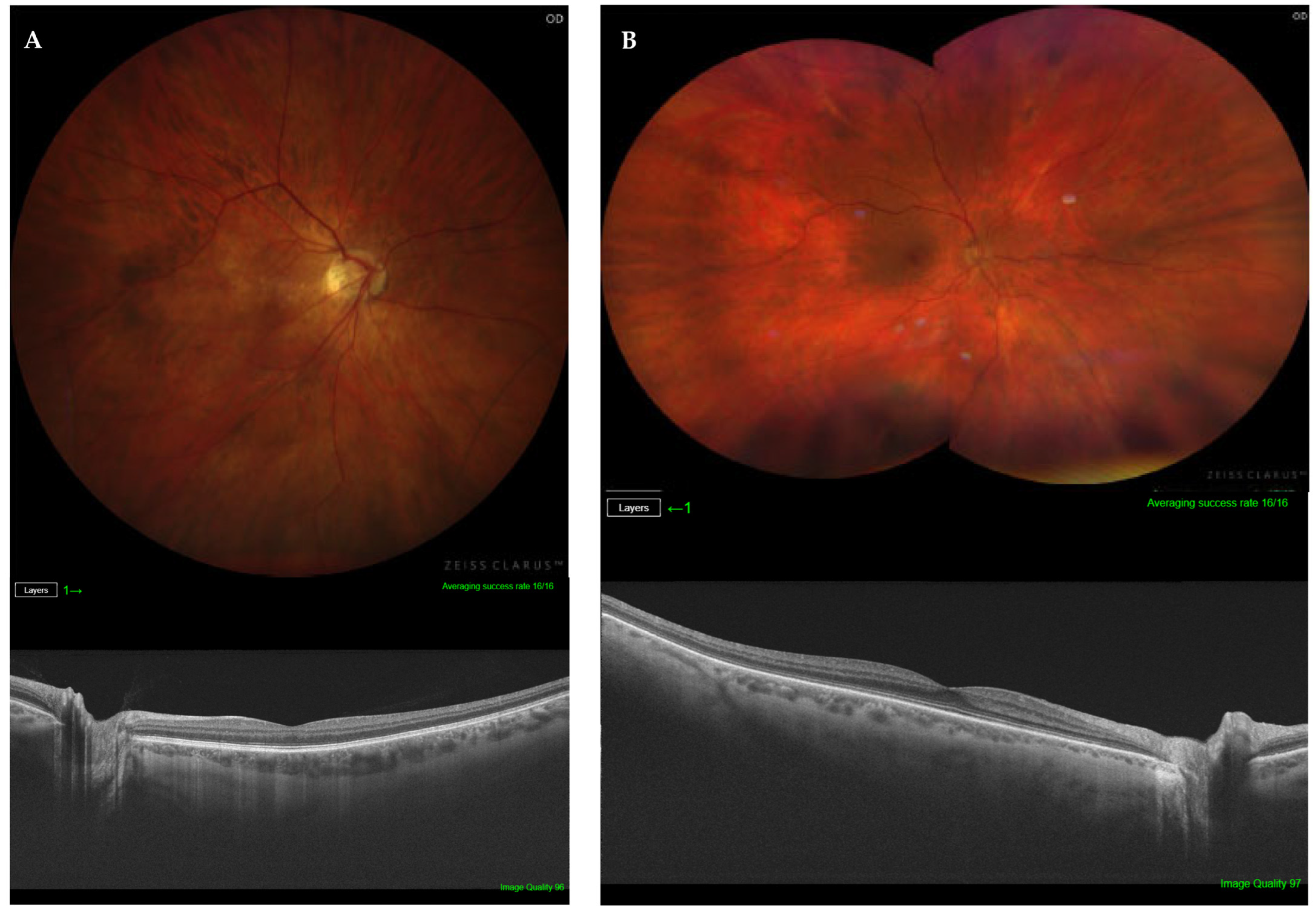 Diagnostics 14 01581 g003